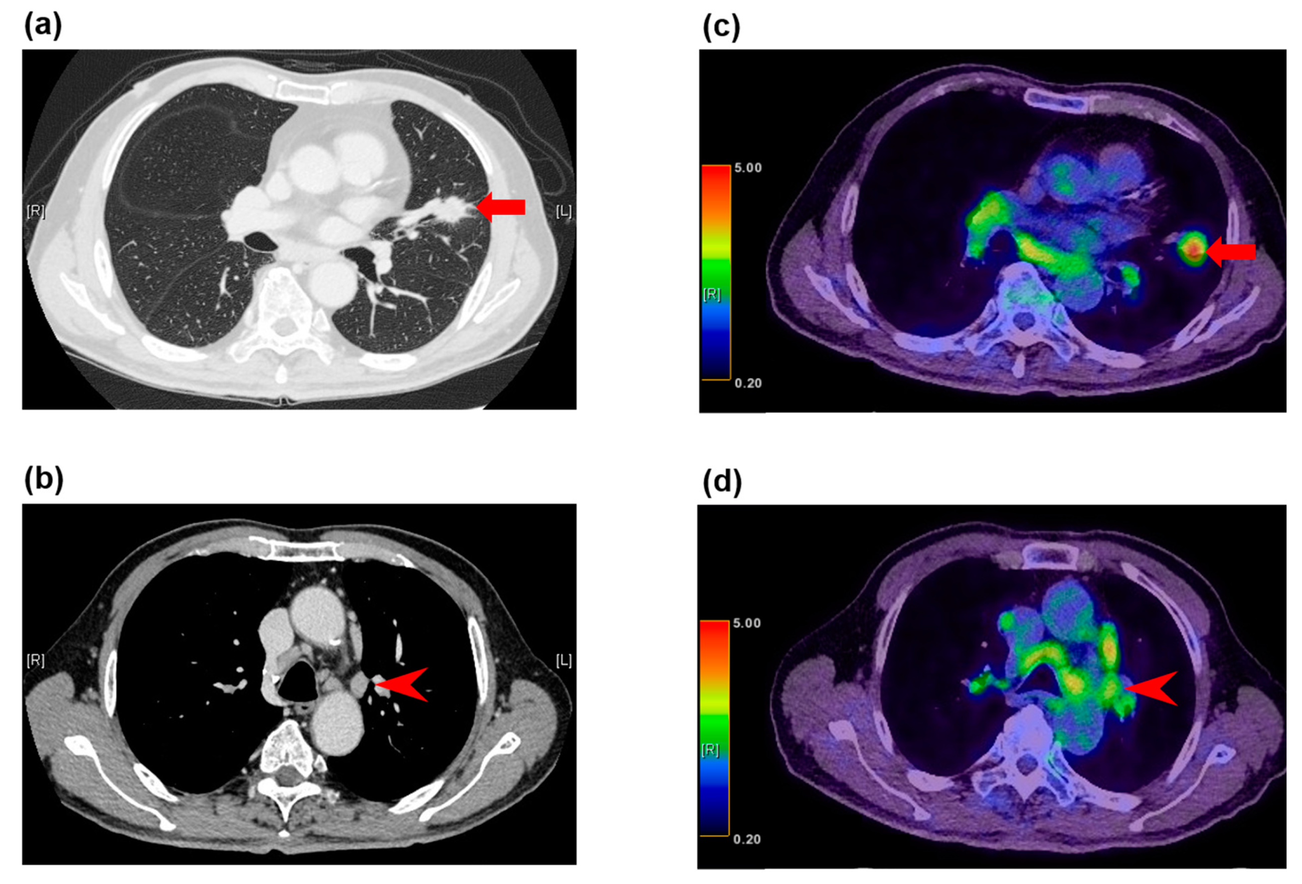 Diagnostics | Free Full-Text | and Current Advances in FDG-PET Imaging within the Field of Clinical Oncology in A Review of the Literature