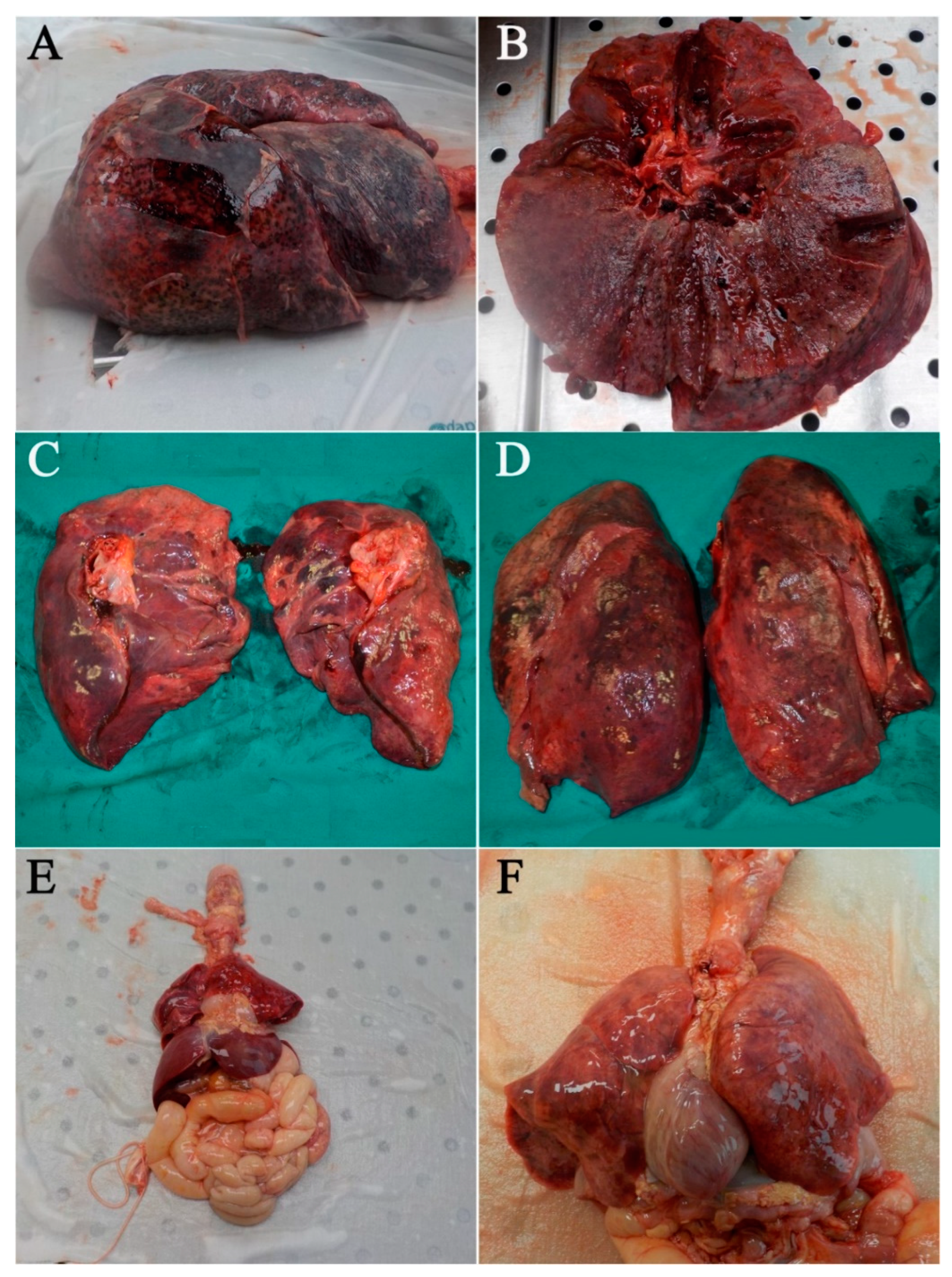 Diagnostics | Free Full-Text | Preliminary Post-Mortem COVID-19 Evidence of  Endothelial Injury and Factor VIII Hyperexpression