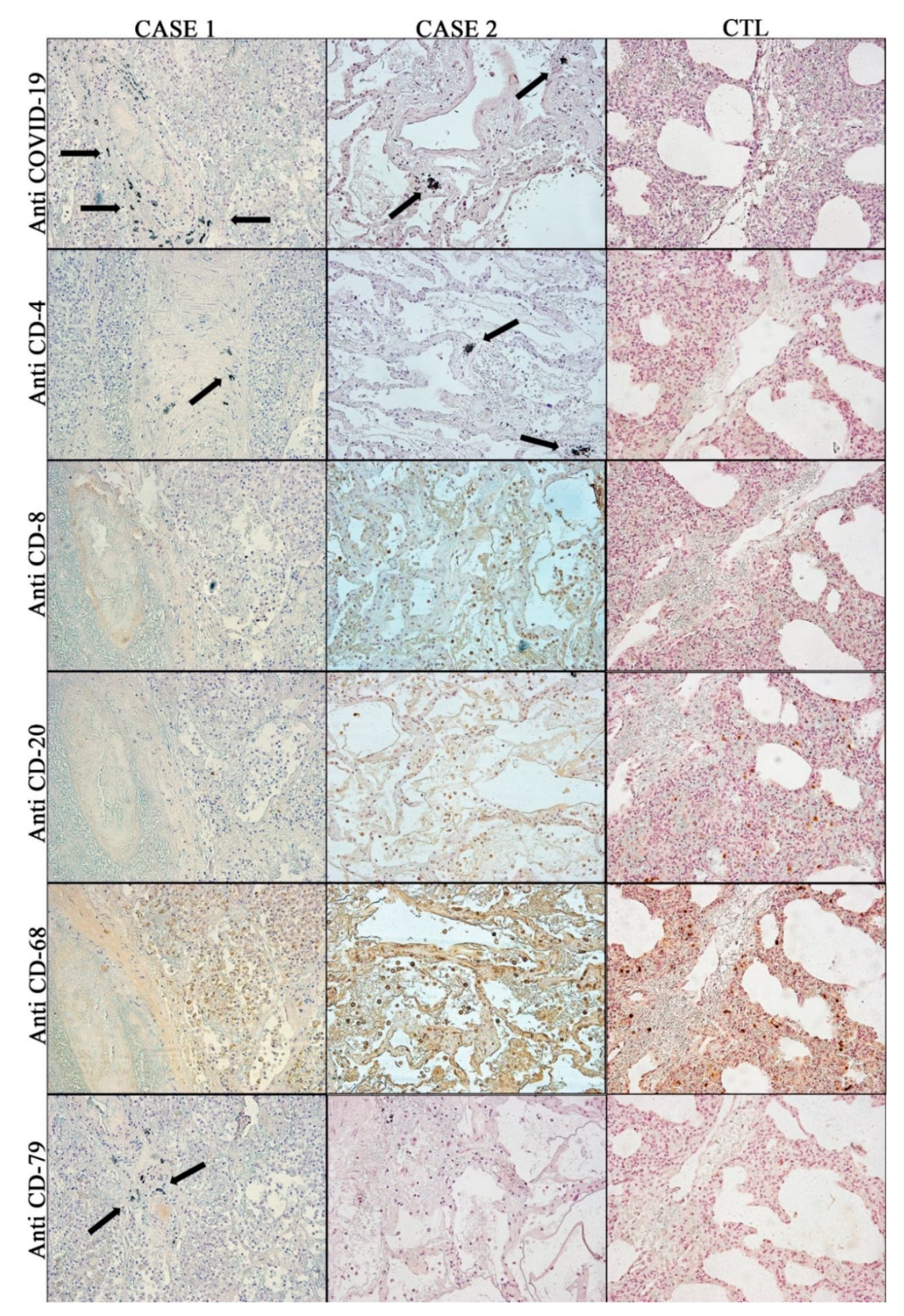 Diagnostics 10 00575 g004 Diagnostics 10 00575 g004