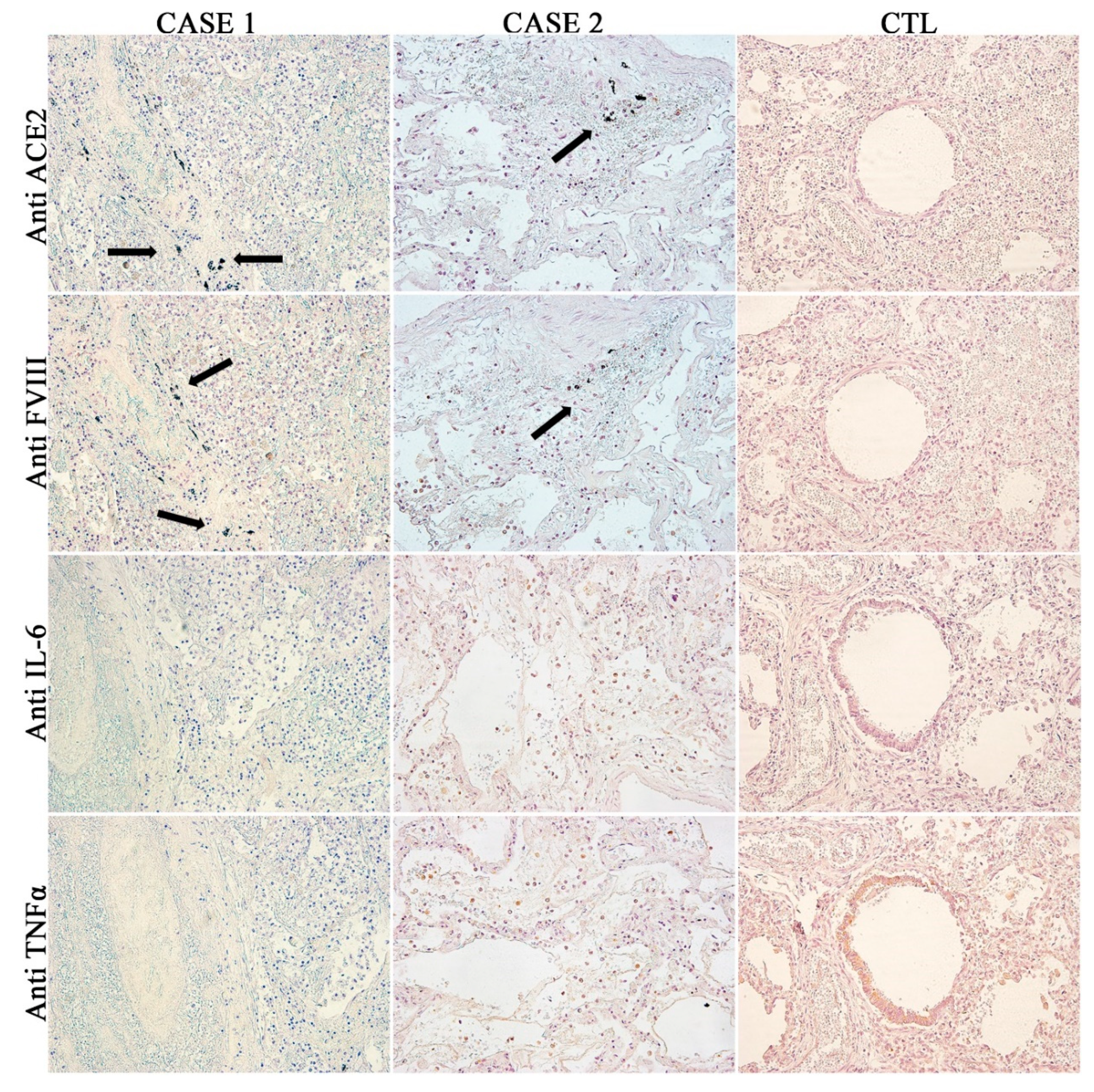 Diagnostics 10 00575 g005 Diagnostics 10 00575 g005