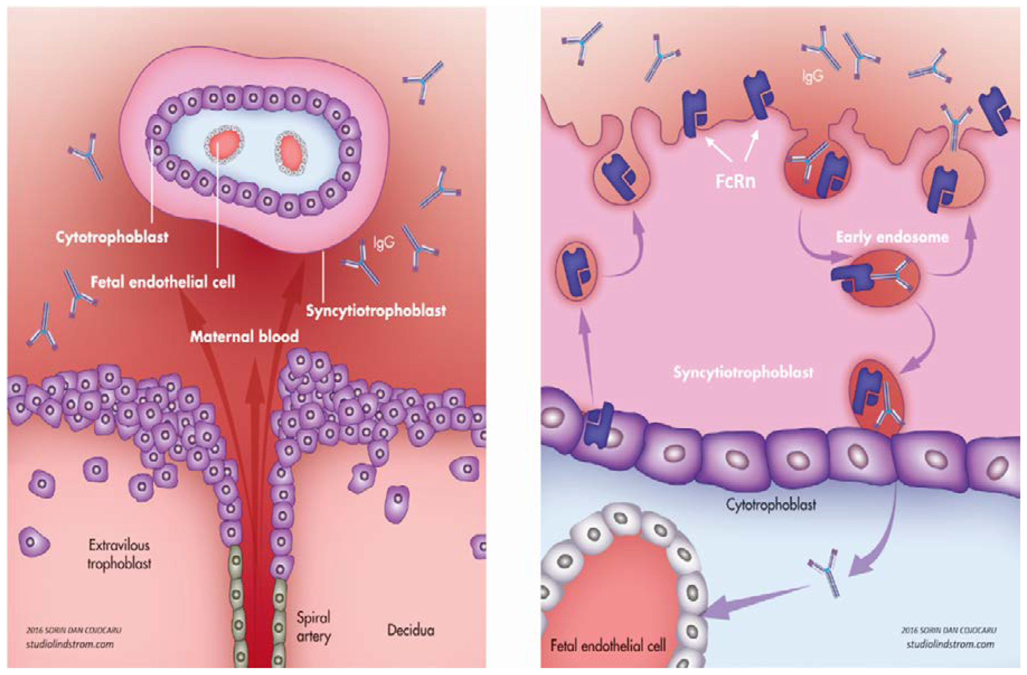 Diagnostics | Free Full-Text | Benefits and Risks of IgG