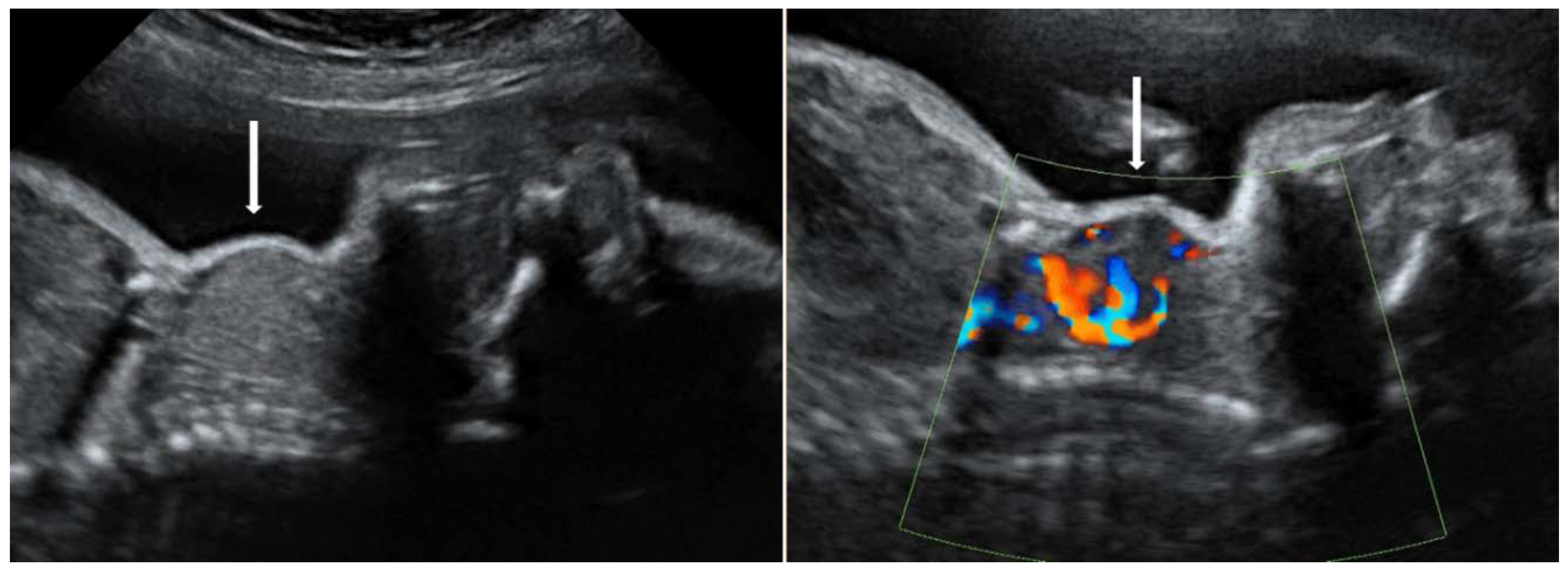 Diagnostics 10 00583 g003 Diagnostics 10 00583 g003