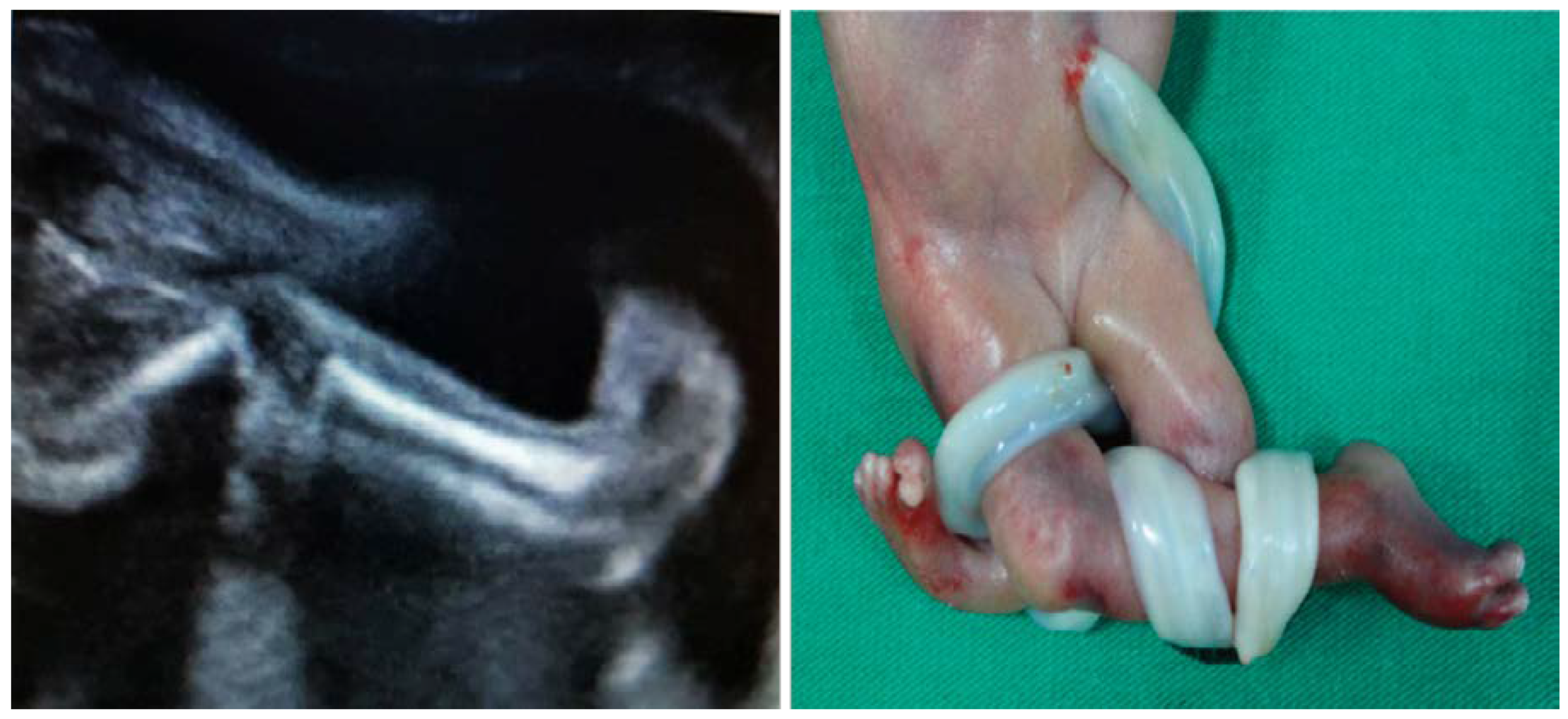 Diagnostics 10 00583 g004 Diagnostics 10 00583 g004