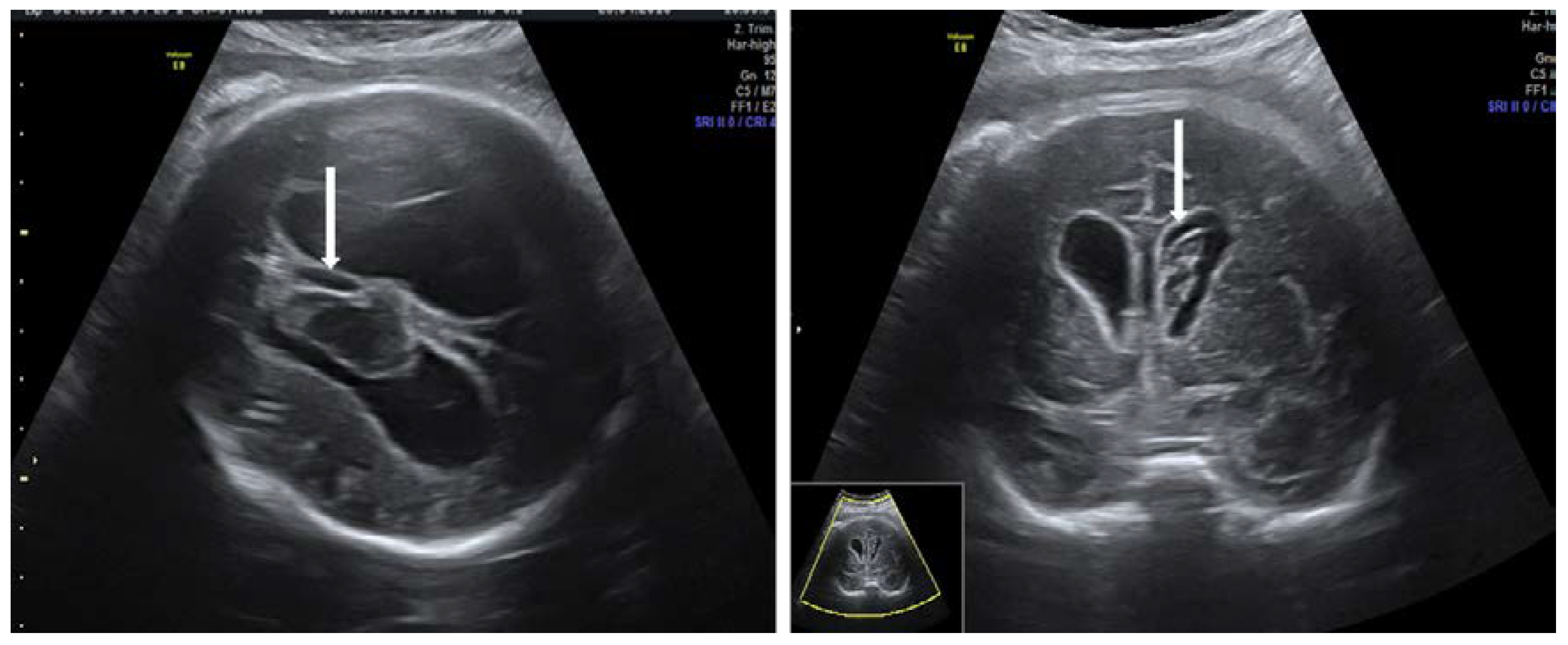 Diagnostics 10 00583 g007 Diagnostics 10 00583 g007