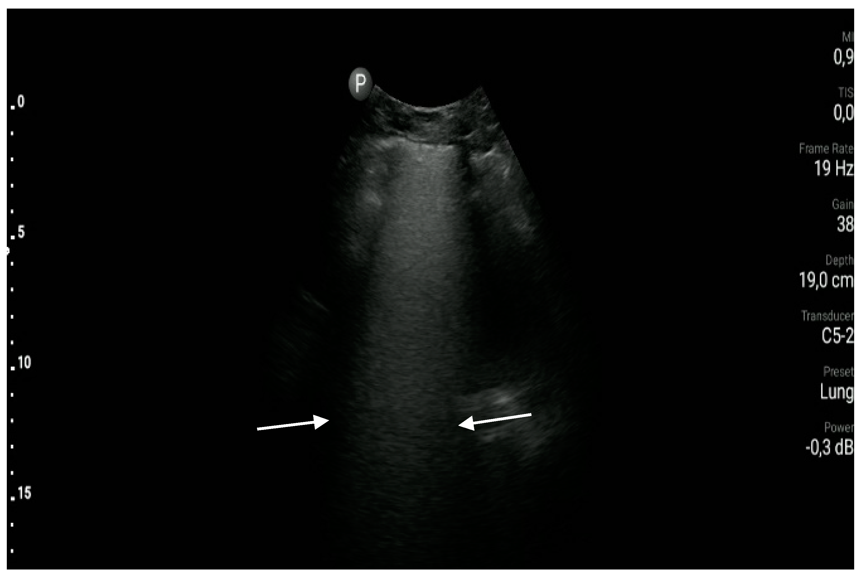 Diagnostics 10 00597 g005