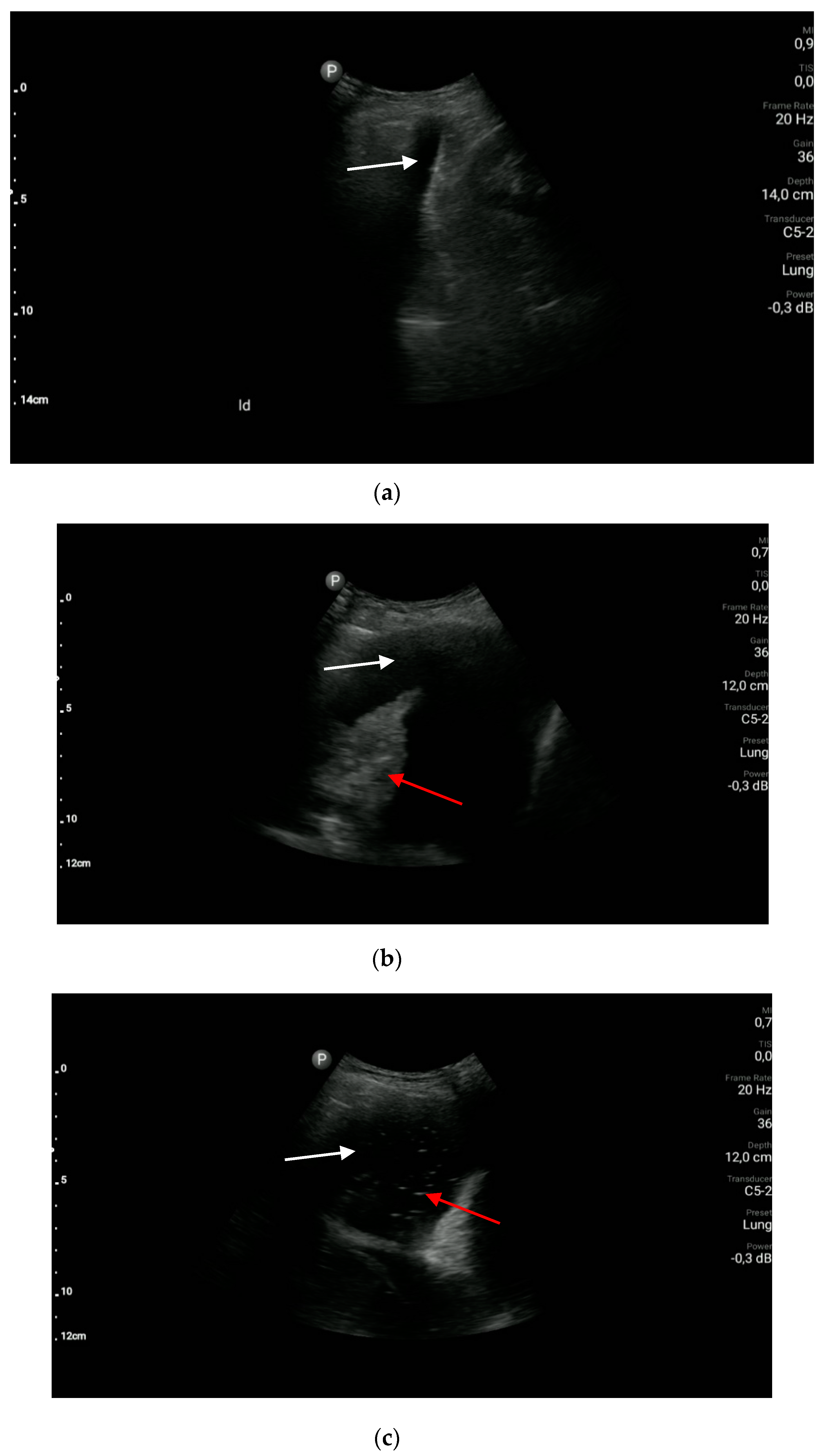 Diagnostics 10 00597 g006