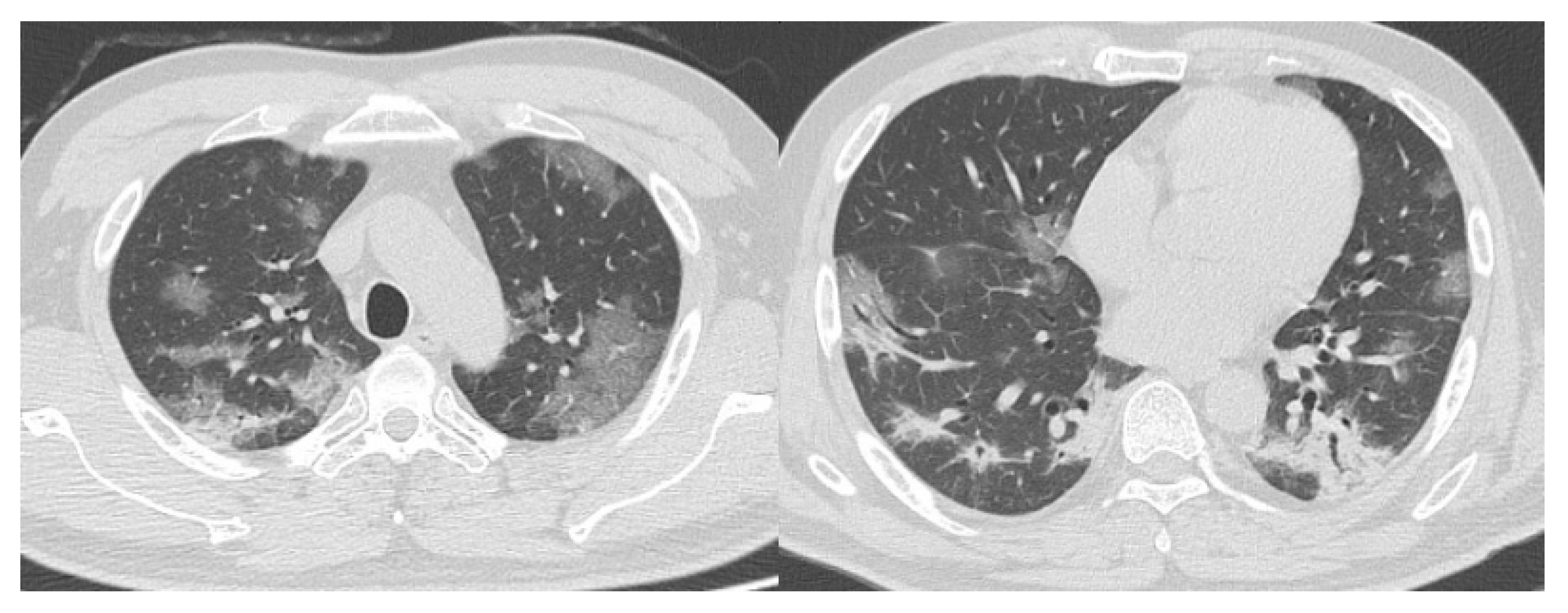 Diagnostics 10 00608 g003