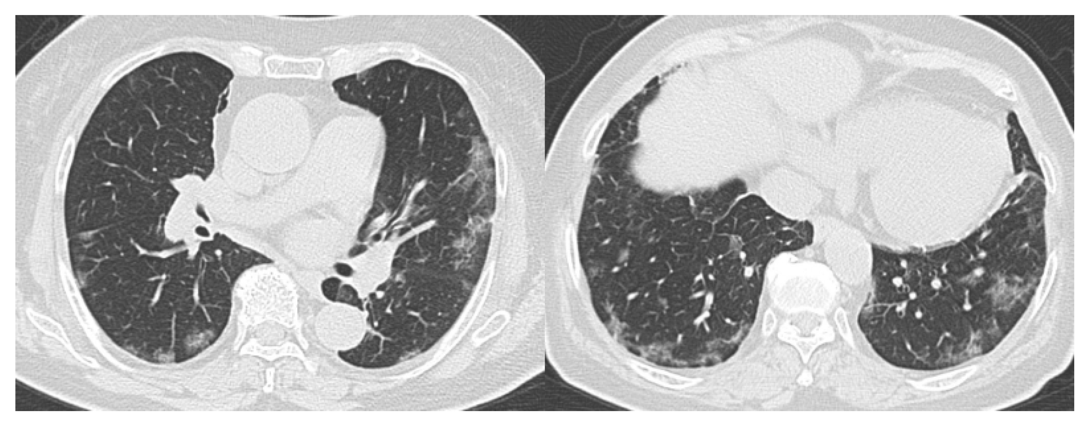 Diagnostics 10 00608 g004