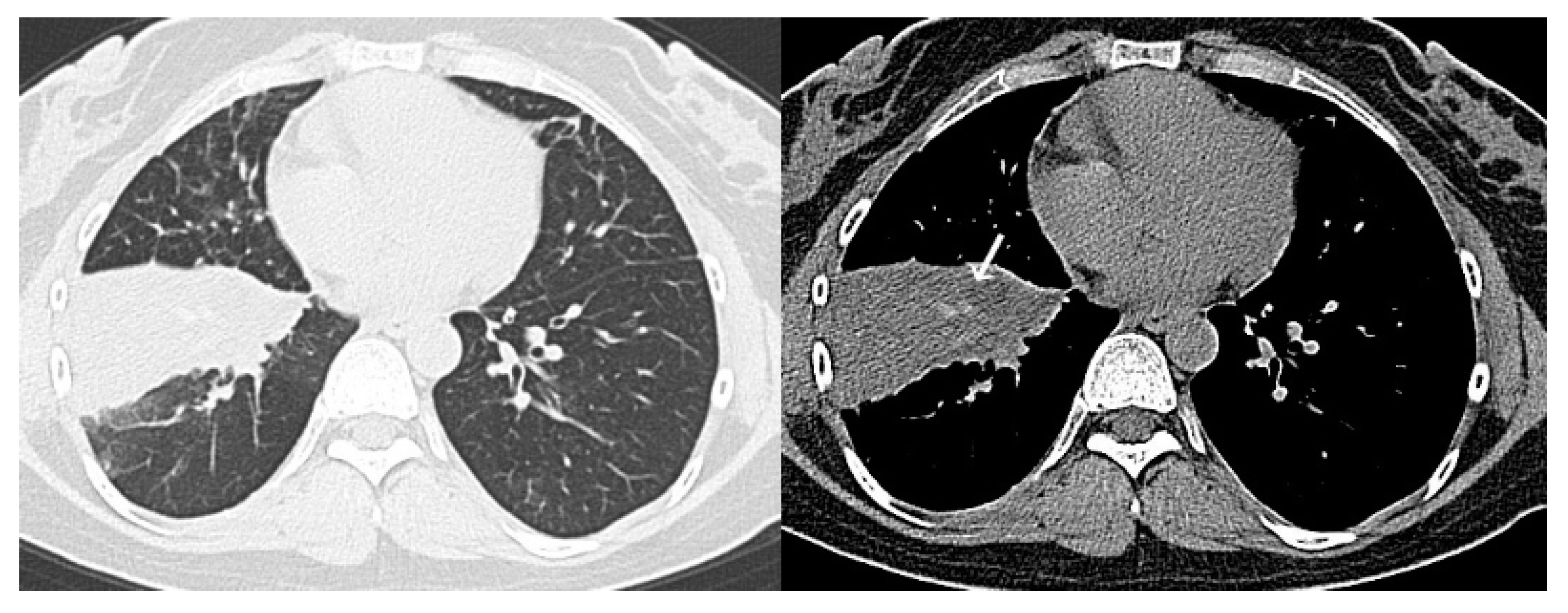 Diagnostics 10 00608 g005