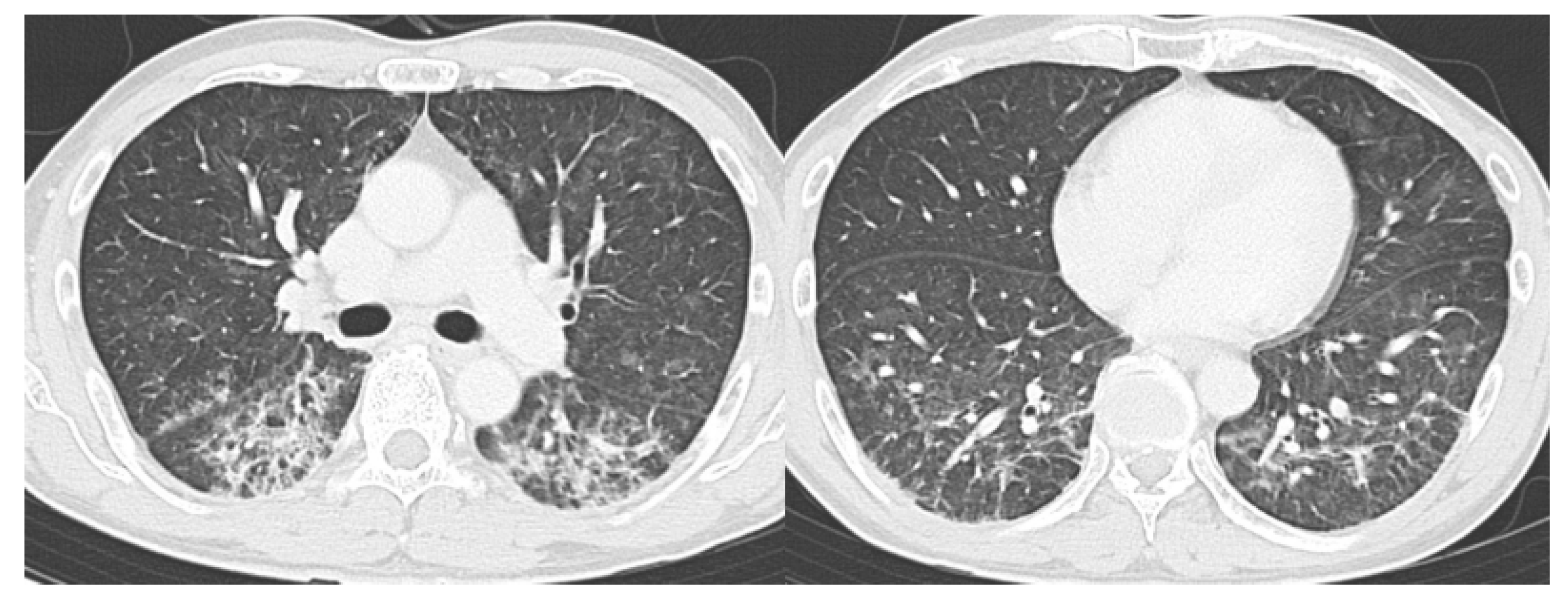 Diagnostics 10 00608 g007
