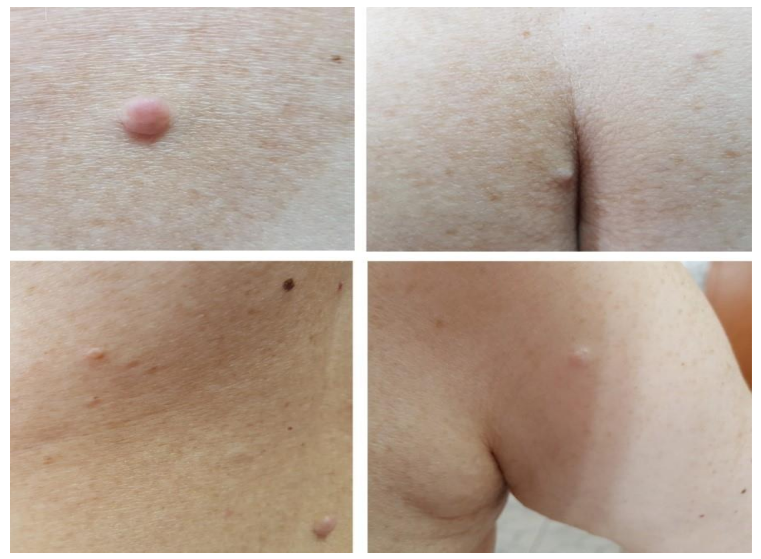 Diagnostics 10 00620 g003 Diagnostics 10 00620 g003