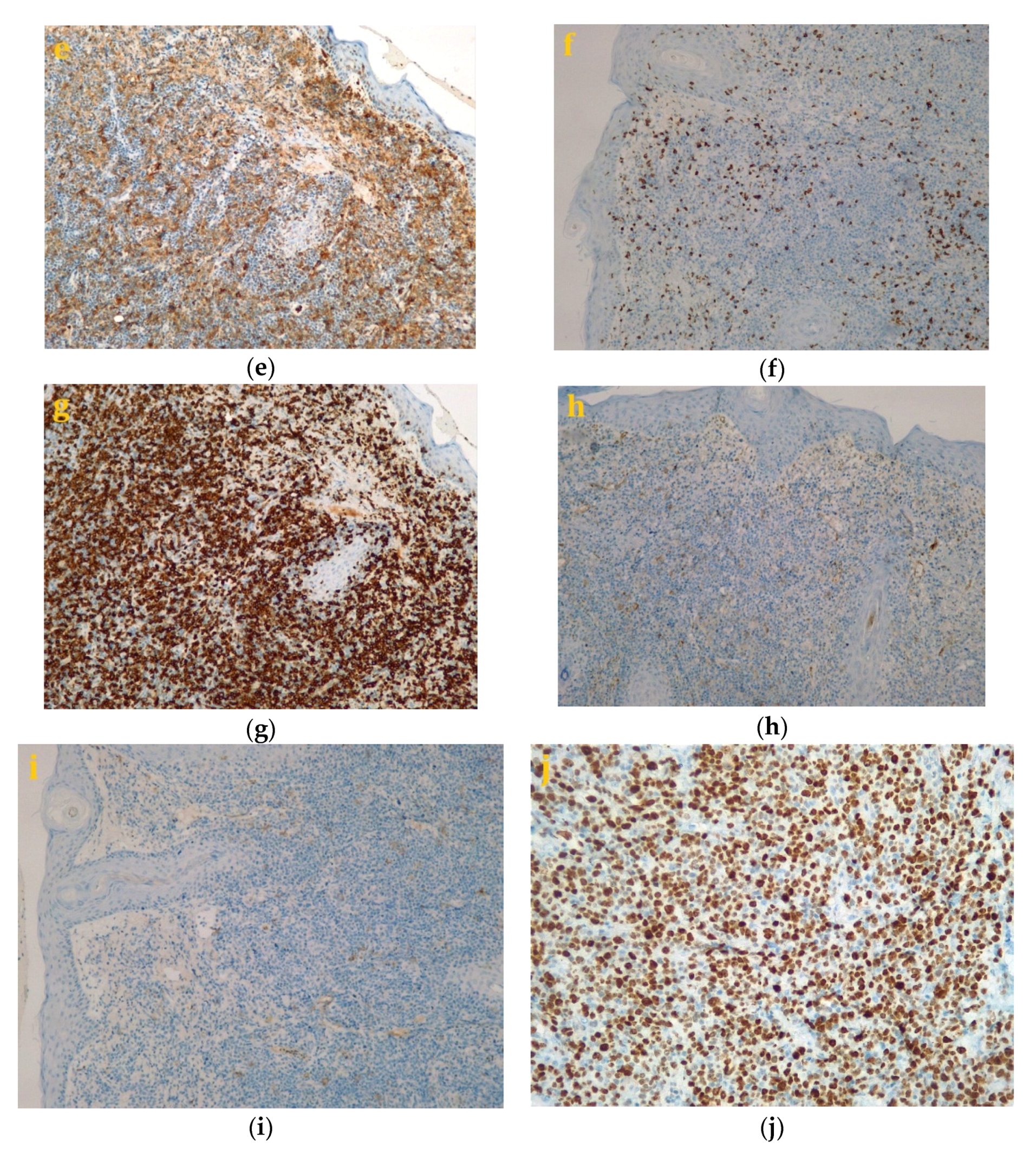 Diagnostics 10 00629 g003b Diagnostics 10 00629 g003b