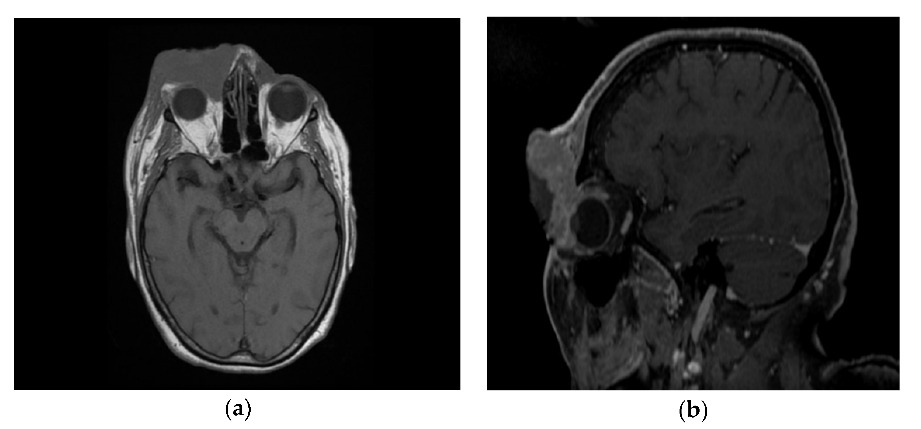 Diagnostics 10 00629 g004 Diagnostics 10 00629 g004