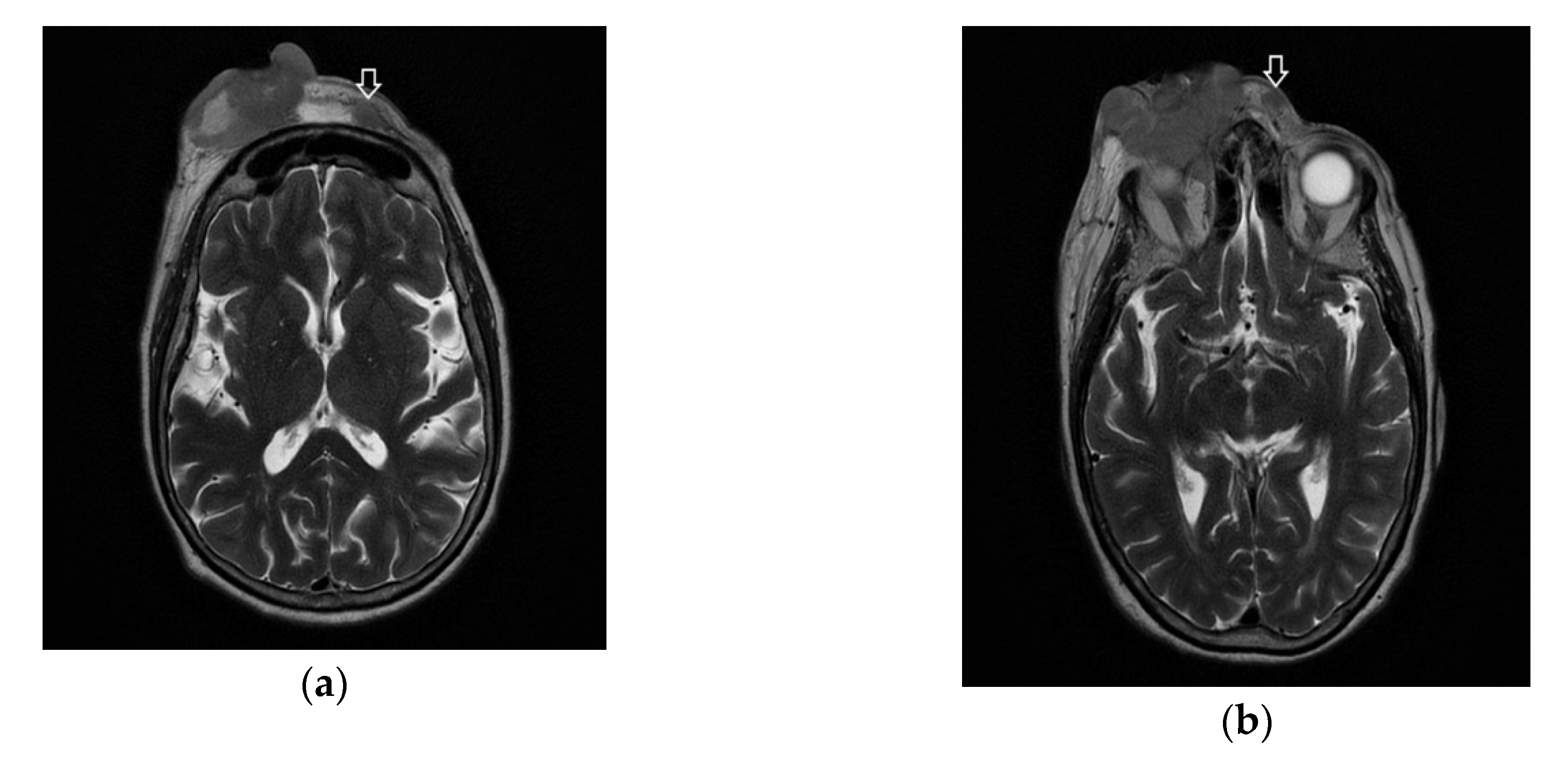 Diagnostics 10 00629 g005 Diagnostics 10 00629 g005