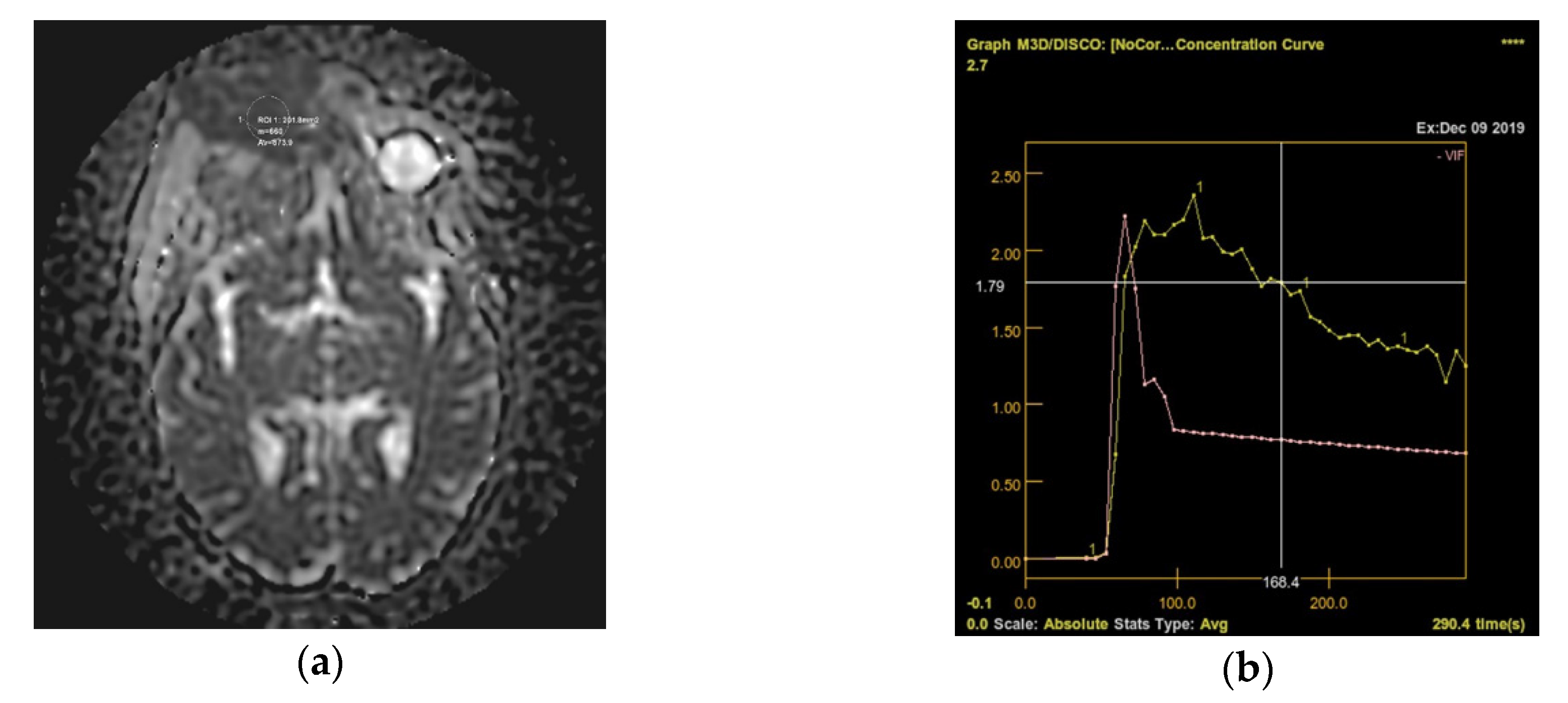 Diagnostics 10 00629 g006 Diagnostics 10 00629 g006