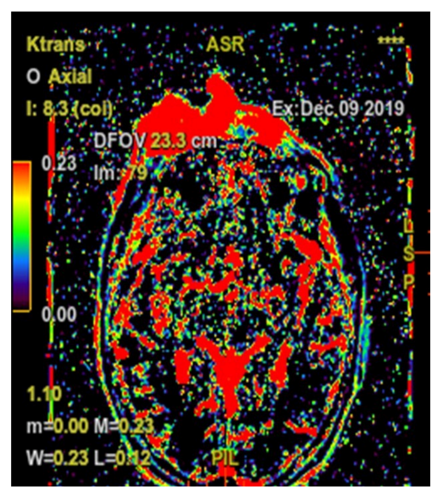 Diagnostics 10 00629 g007 Diagnostics 10 00629 g007