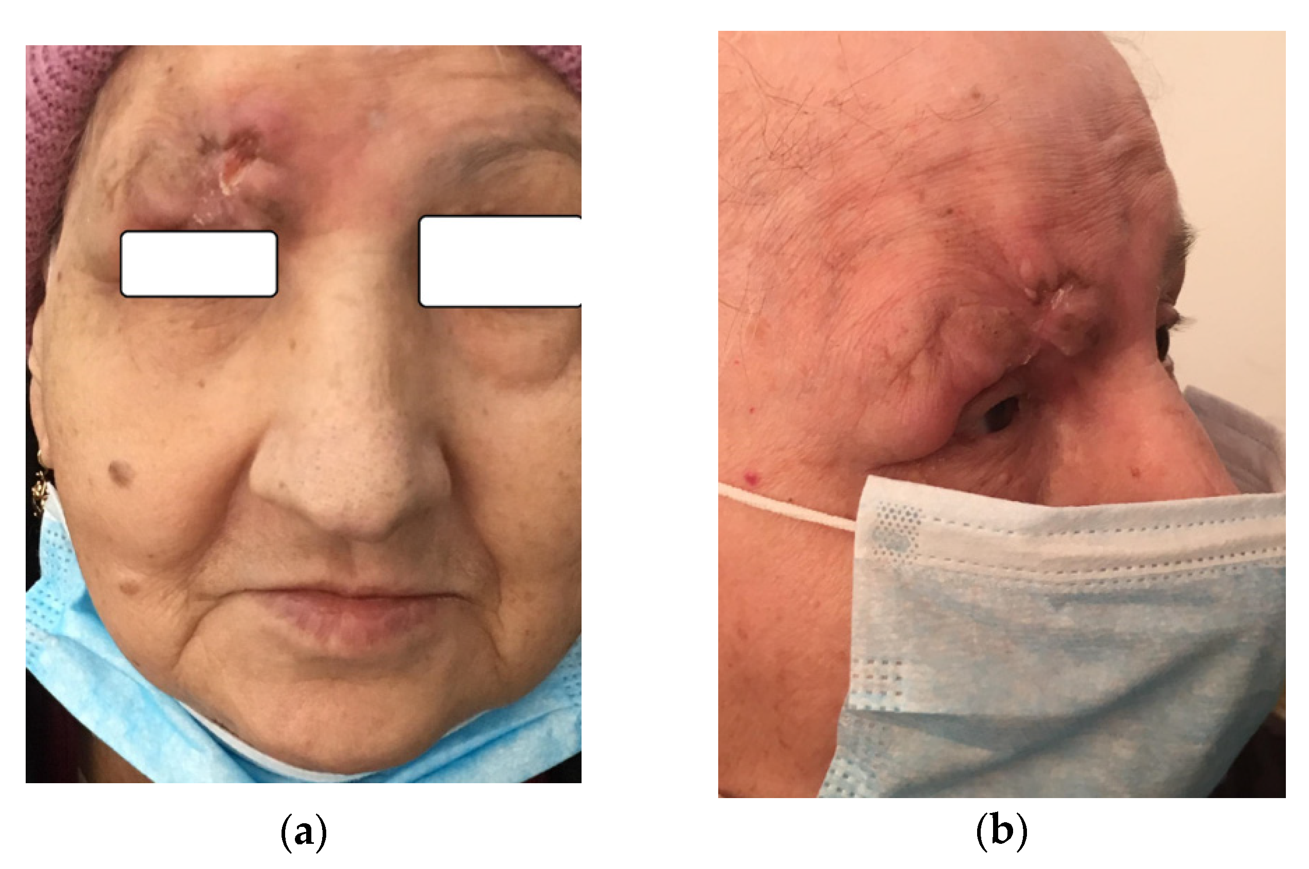 Diagnostics 10 00629 g008a Diagnostics 10 00629 g008a