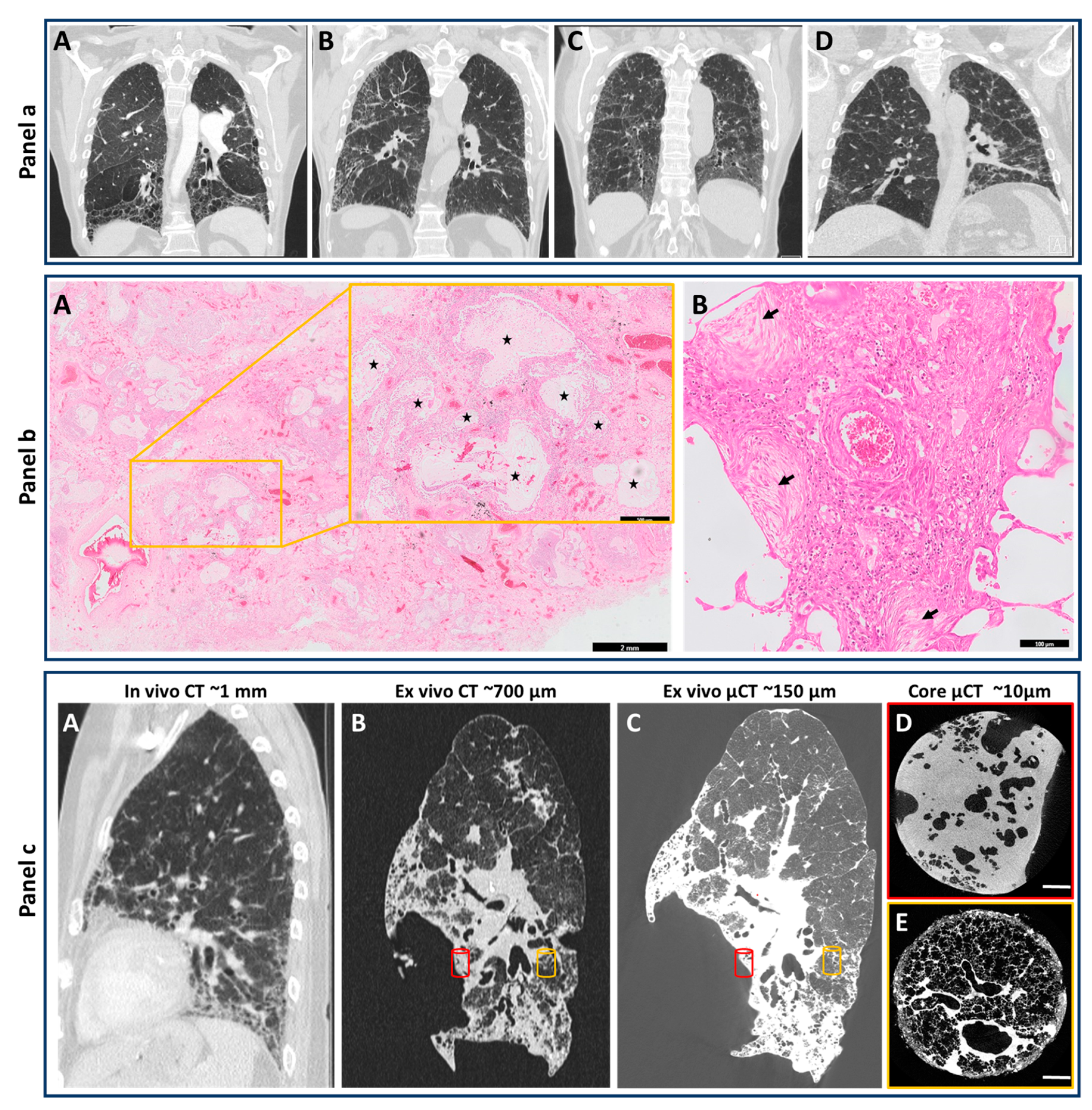 健康・医学 Radiology and Pathology Correlation Radiology and Pathology Correlation of Bone Tumors: A Quick