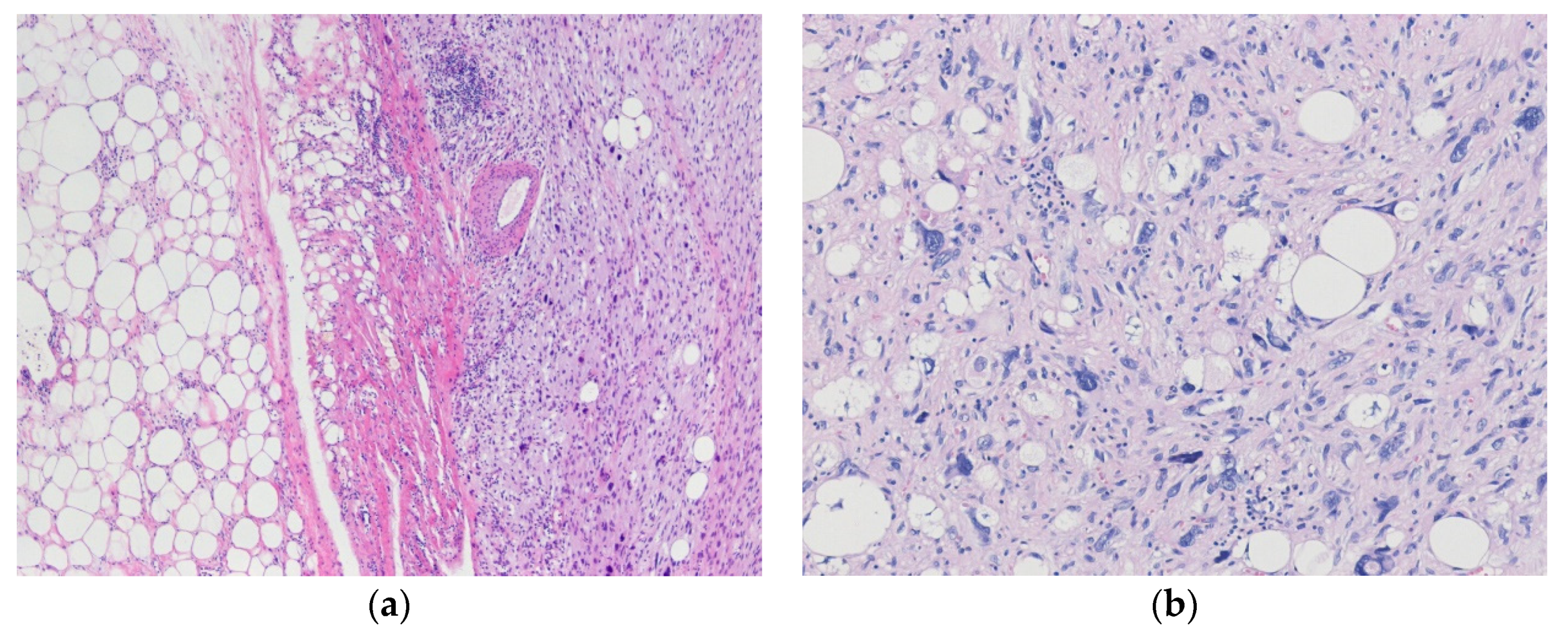 Diagnostics 10 00642 g003 Diagnostics 10 00642 g003