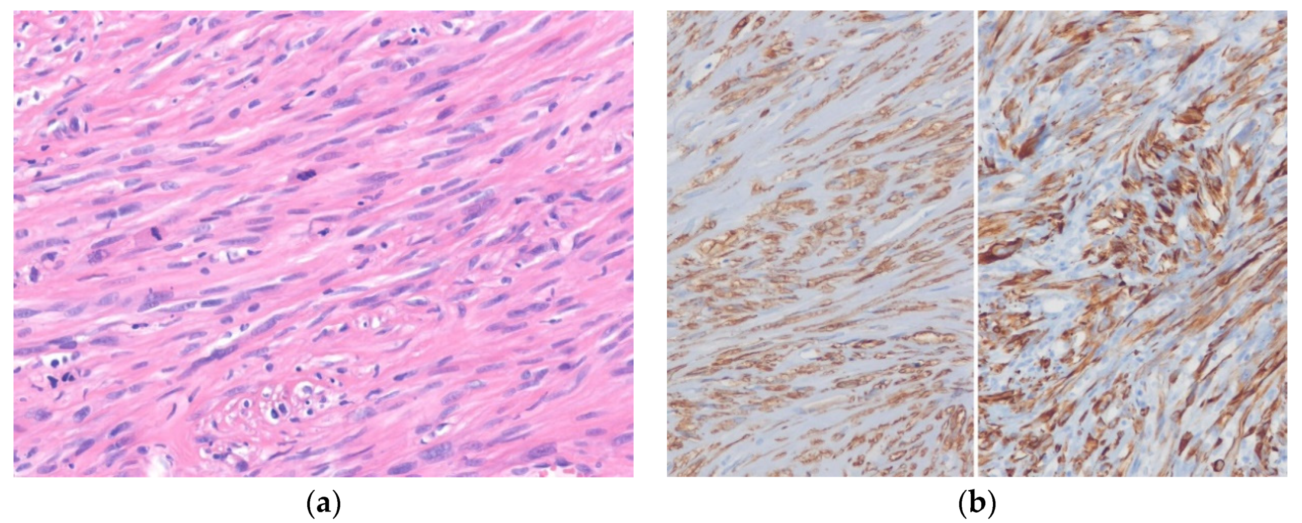 Diagnostics 10 00642 g004 Diagnostics 10 00642 g004