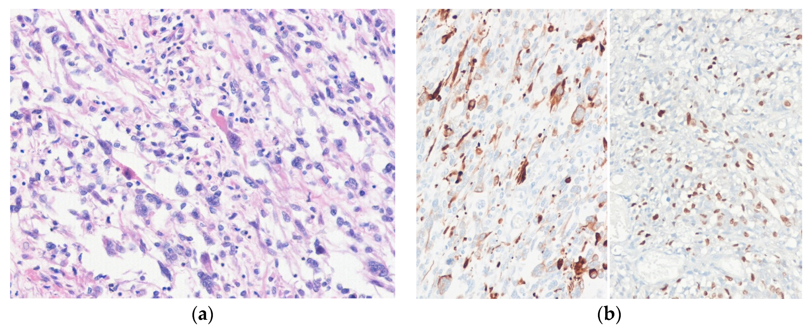 Diagnostics 10 00642 g007 Diagnostics 10 00642 g007