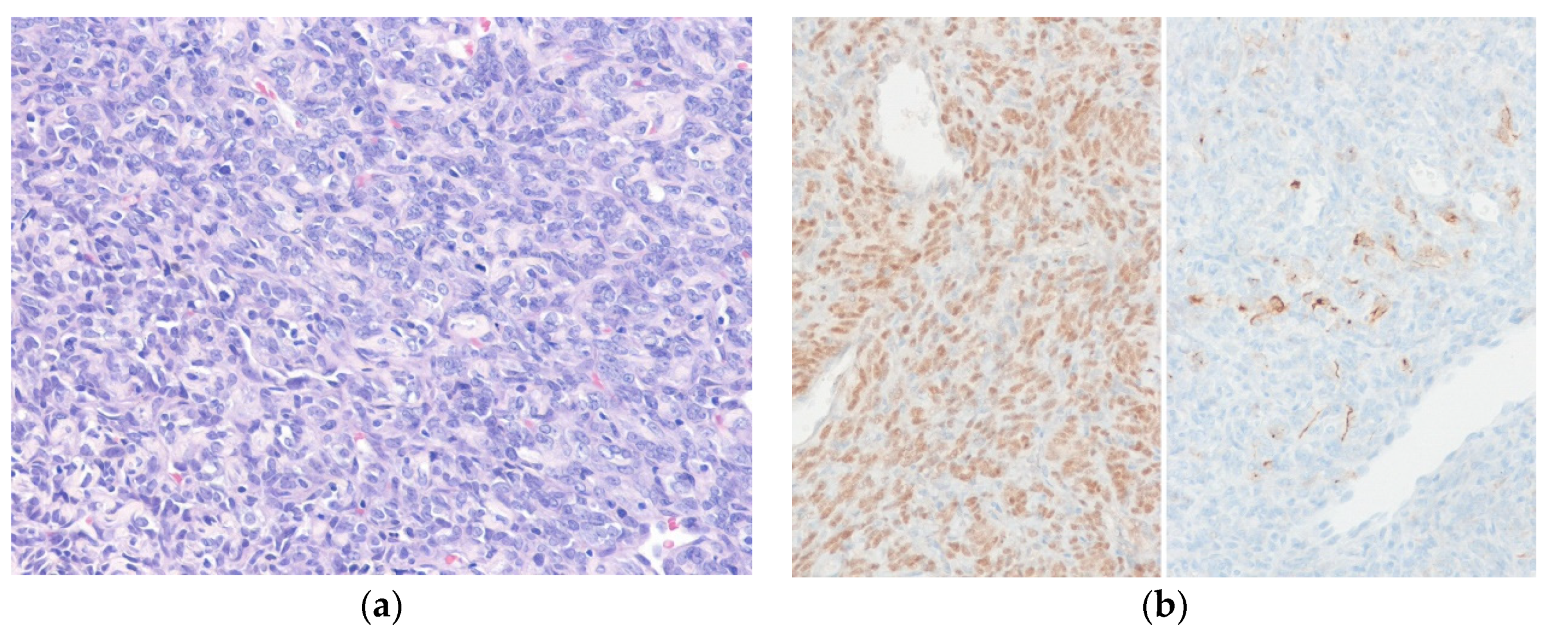 Diagnostics 10 00642 g010 Diagnostics 10 00642 g010