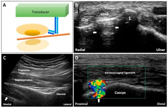 Use of Thoracic Ultrasonography in the Ambulatory and Referral Setting