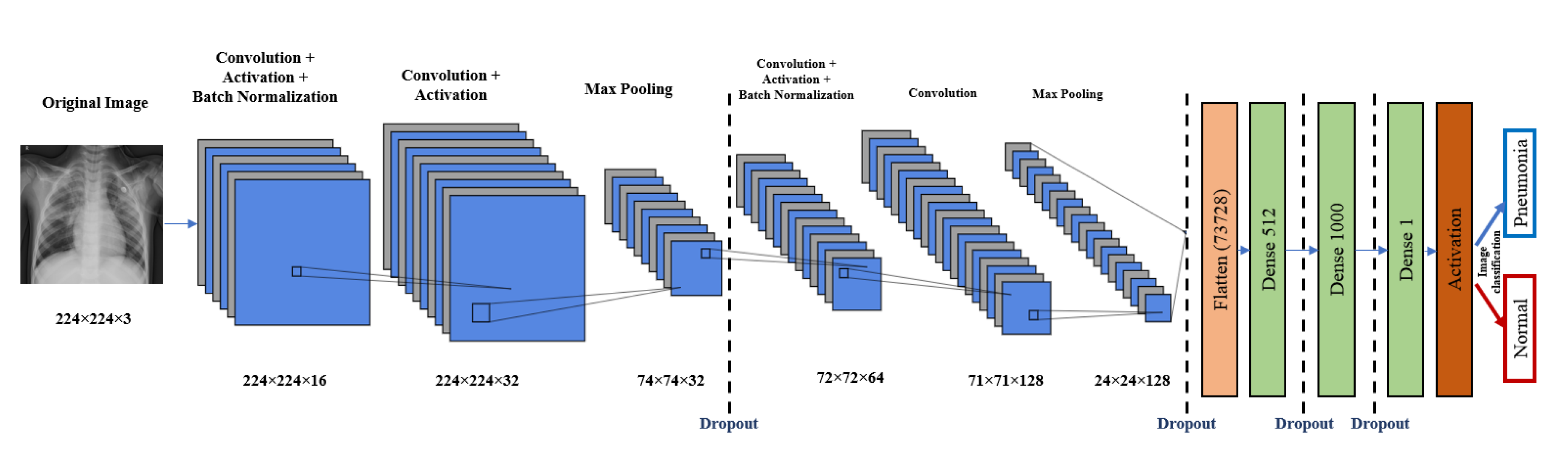 Pneumonia Detection Model Using Deep Learning Deep Le - vrogue.co