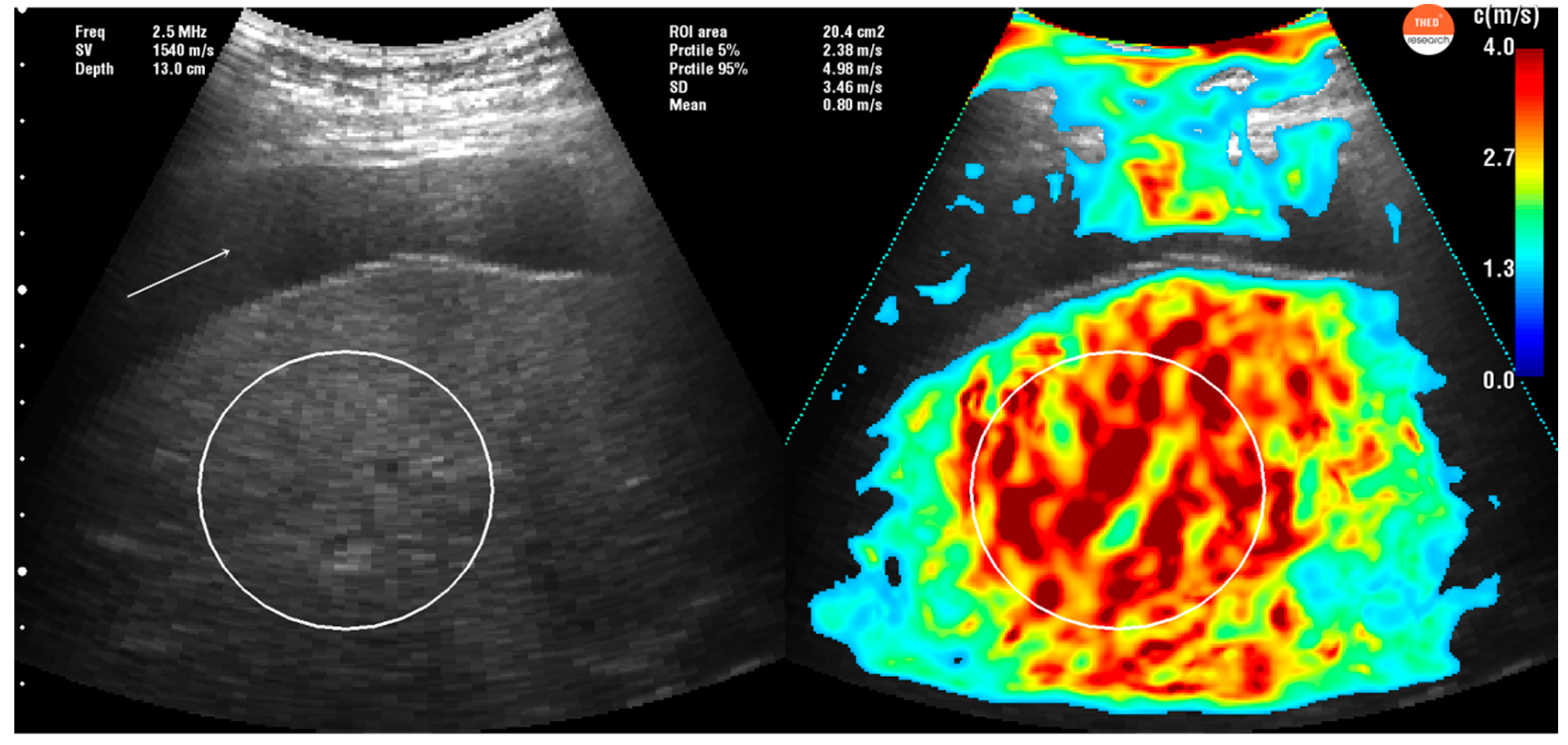 Diagnostics 10 00653 g006 Diagnostics 10 00653 g006