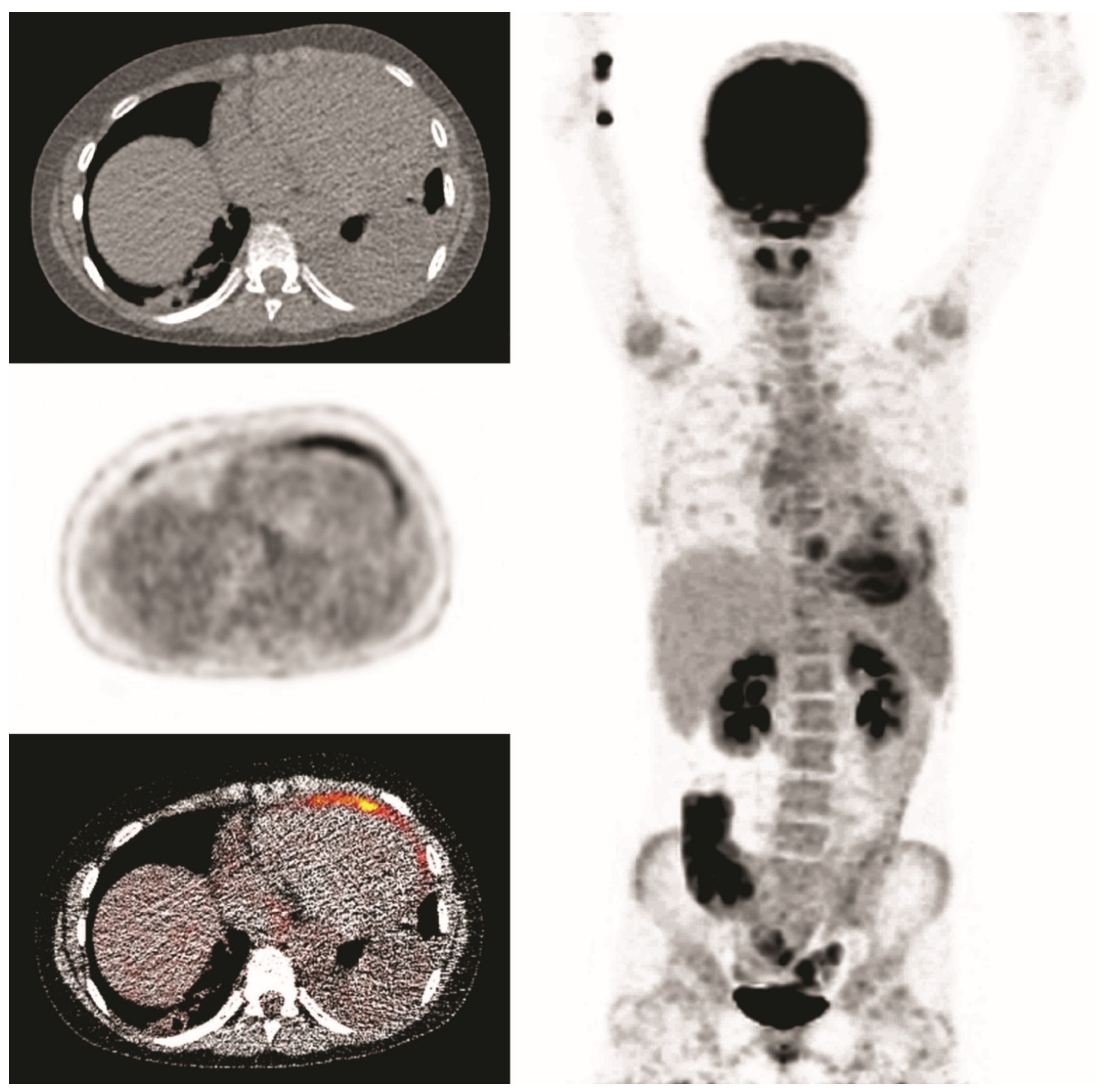 Diagnostics 10 00715 g005