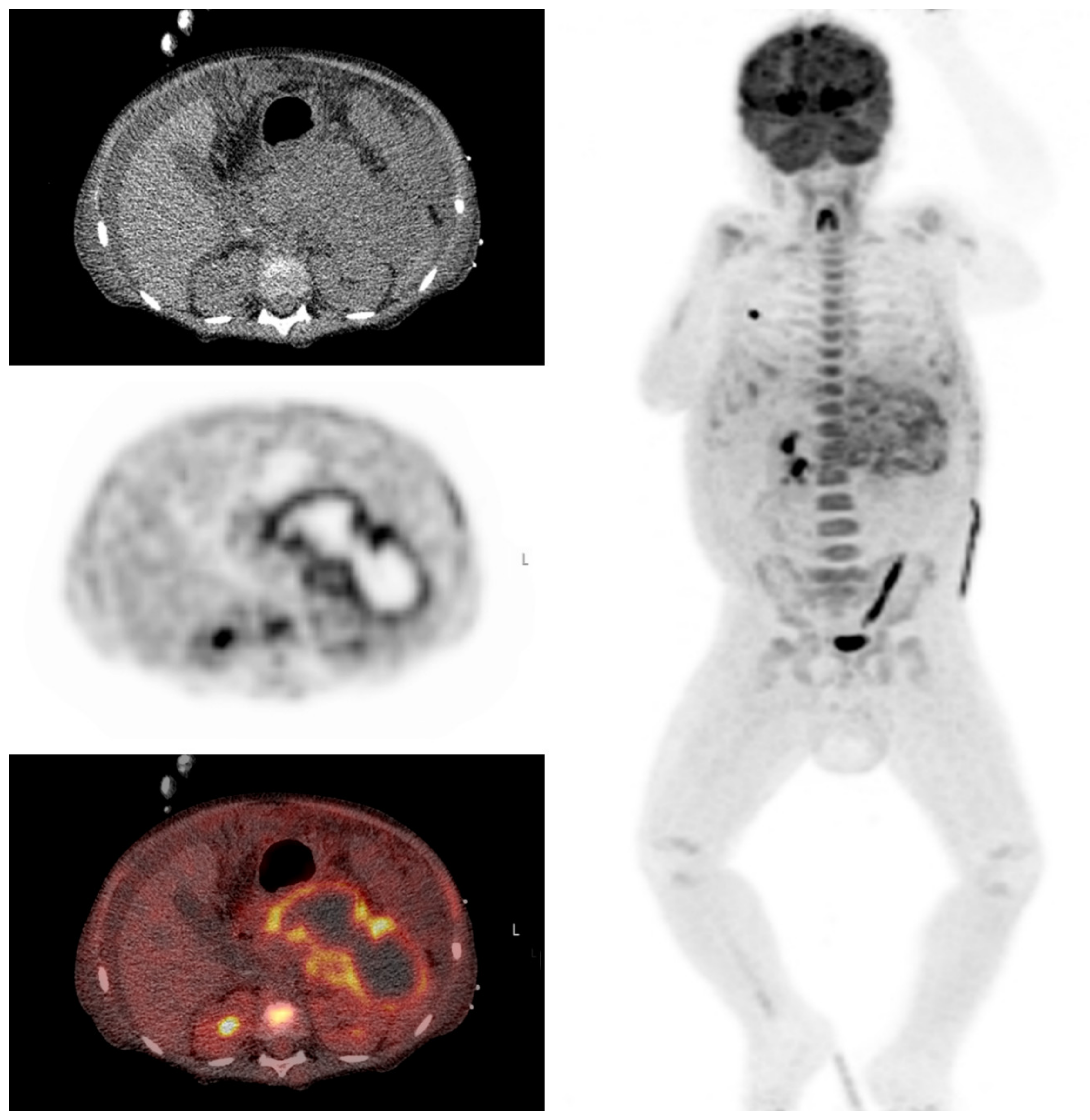 Diagnostics 10 00715 g007