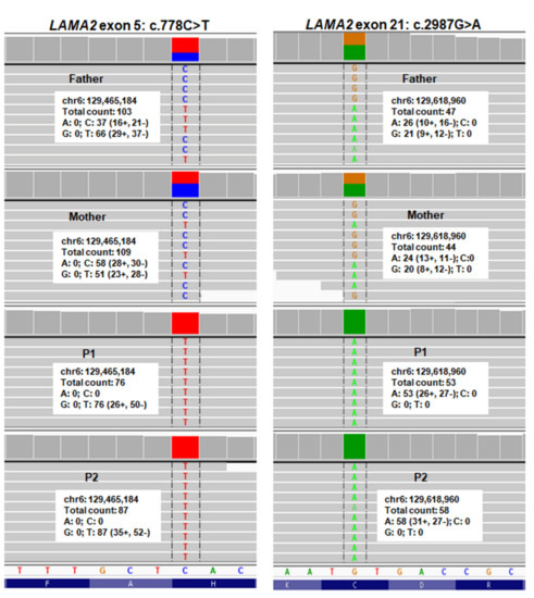 Diagnostics Free Full Text Whole Exome Sequencing As A Diagnostic Tool For Unidentified Muscular Dystrophy In A Vietnamese Family Html