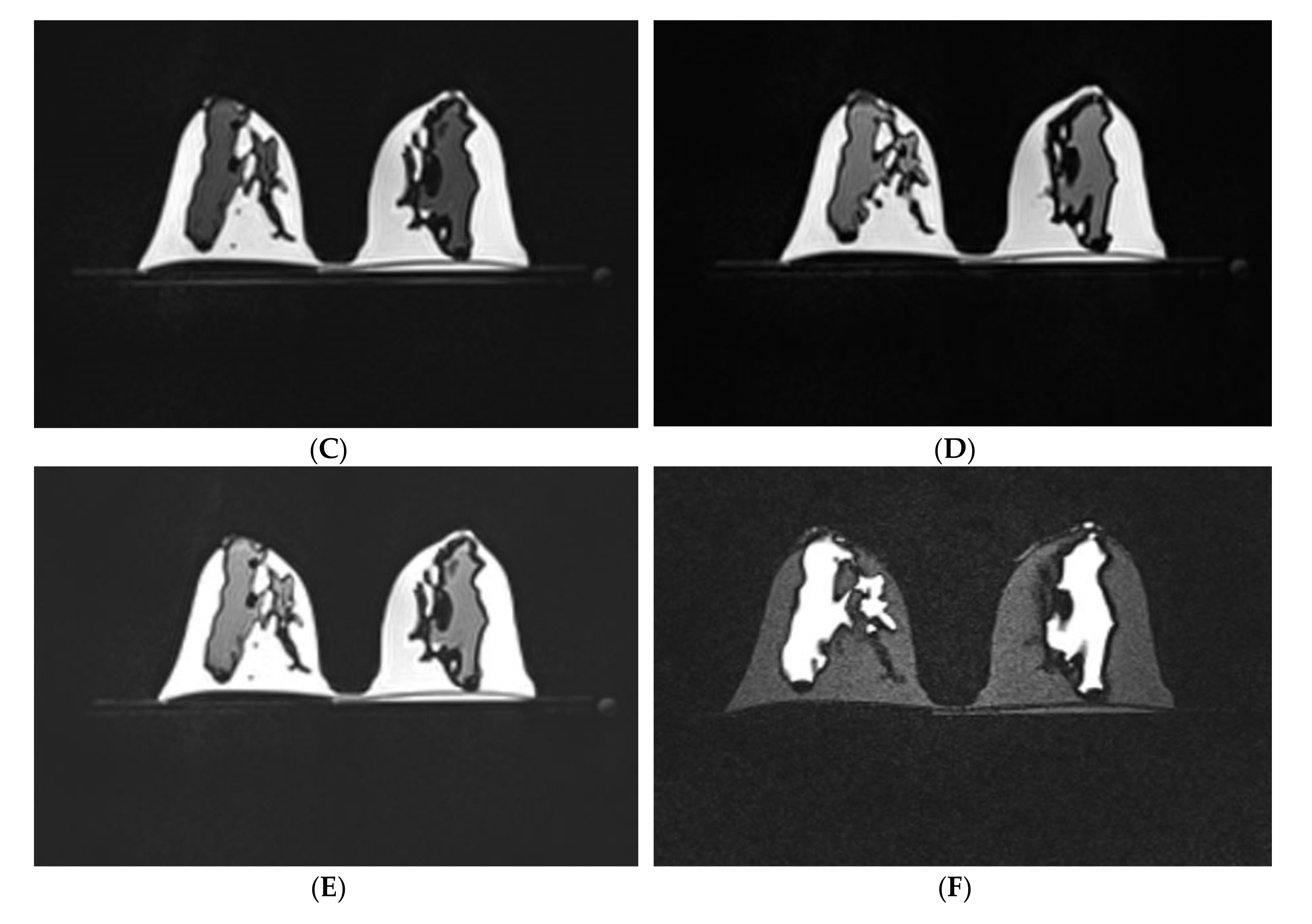 Diagnostics 10 00793 g002b