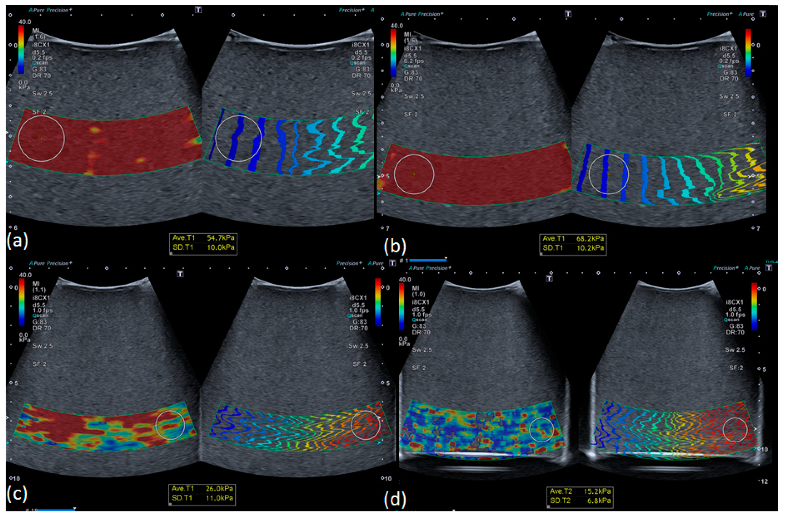 Diagnostics 10 00811 g007