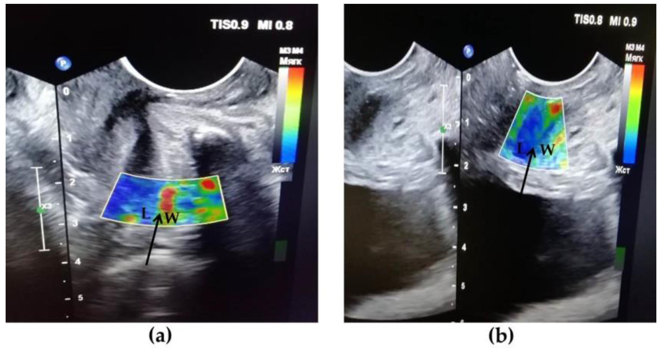 Diagnostics 10 00860 g003