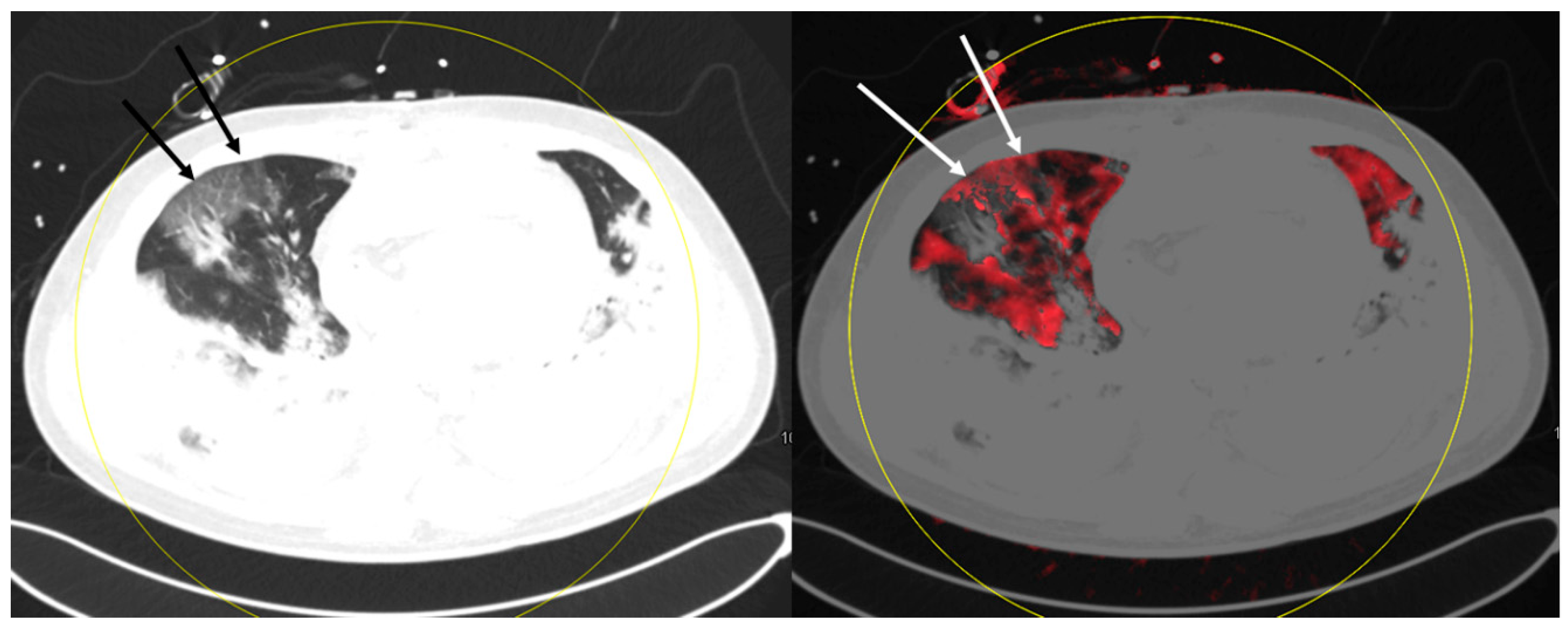 Diagnostics 10 00870 g001