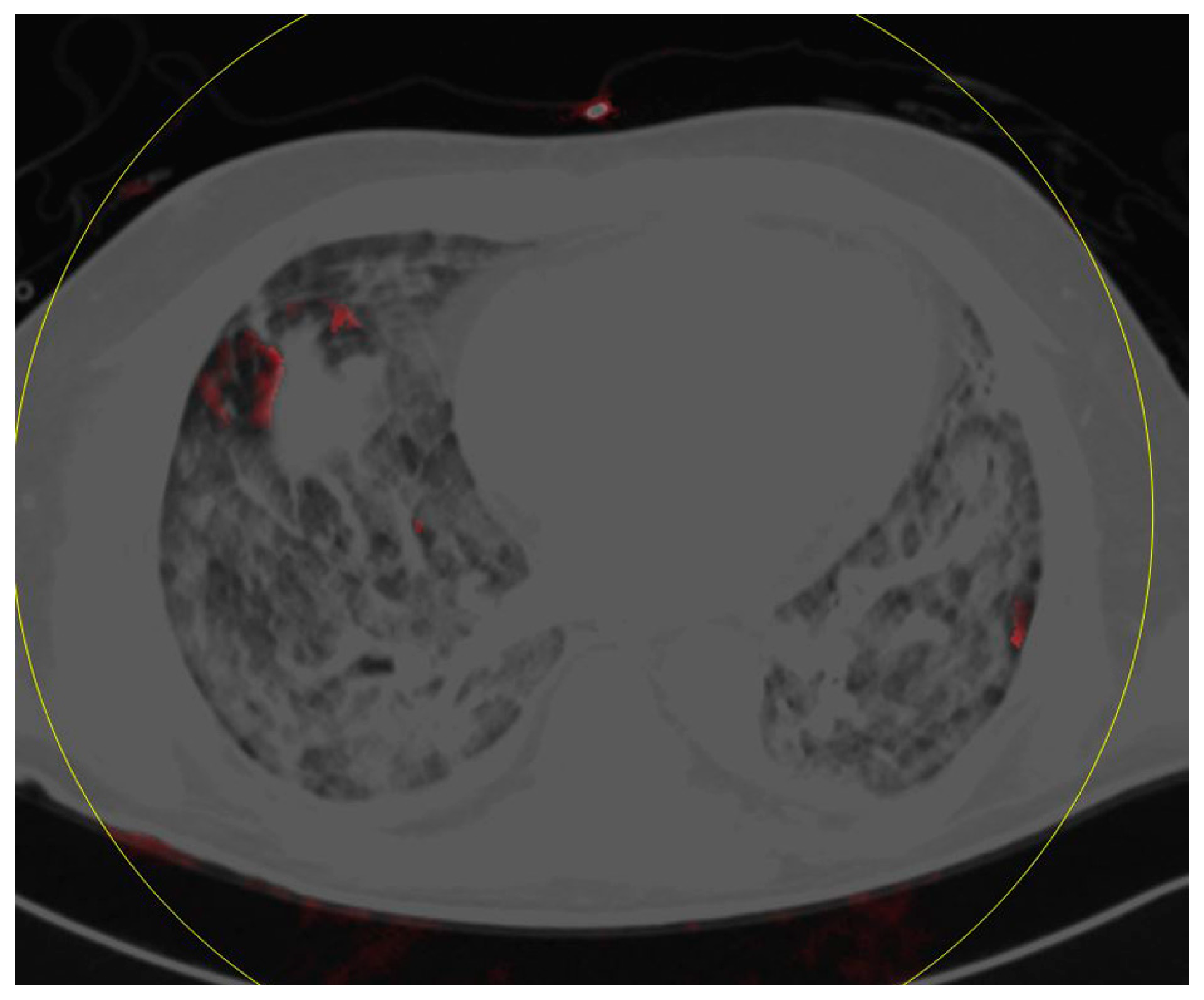 Diagnostics 10 00870 g006