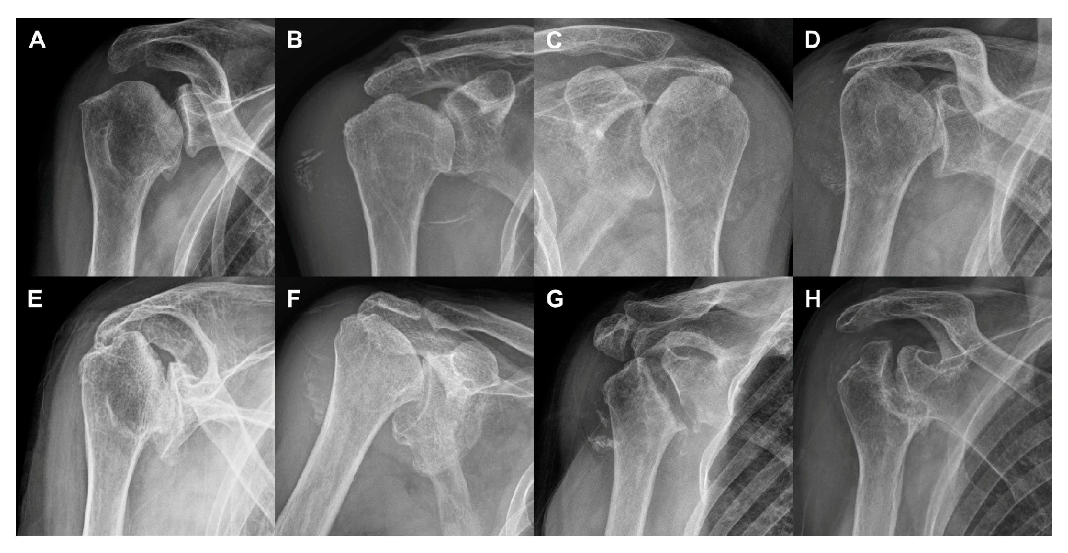 Diagnostics 10 00885 g003 Diagnostics 10 00885 g003