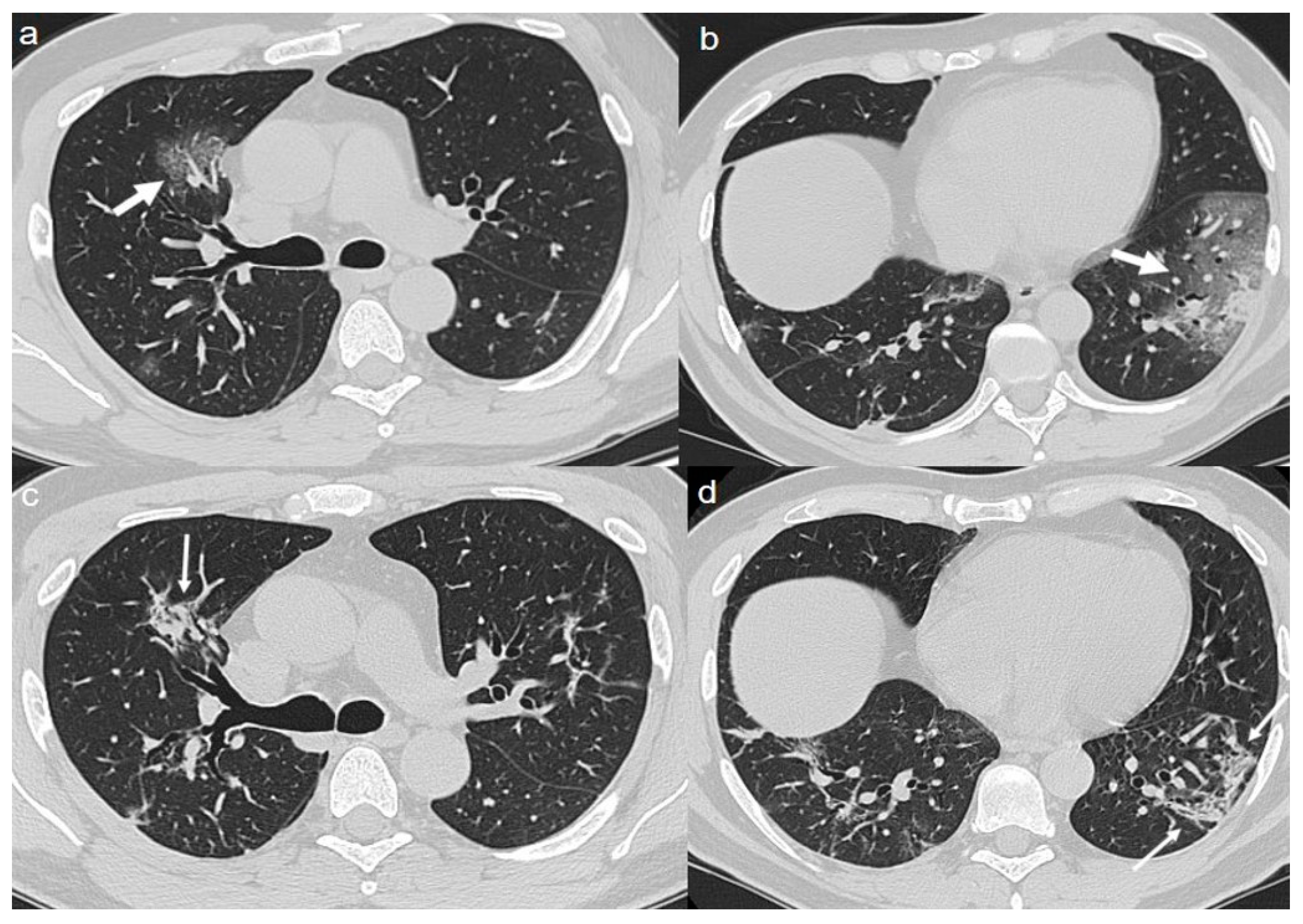 Diagnostics 10 00899 g005
