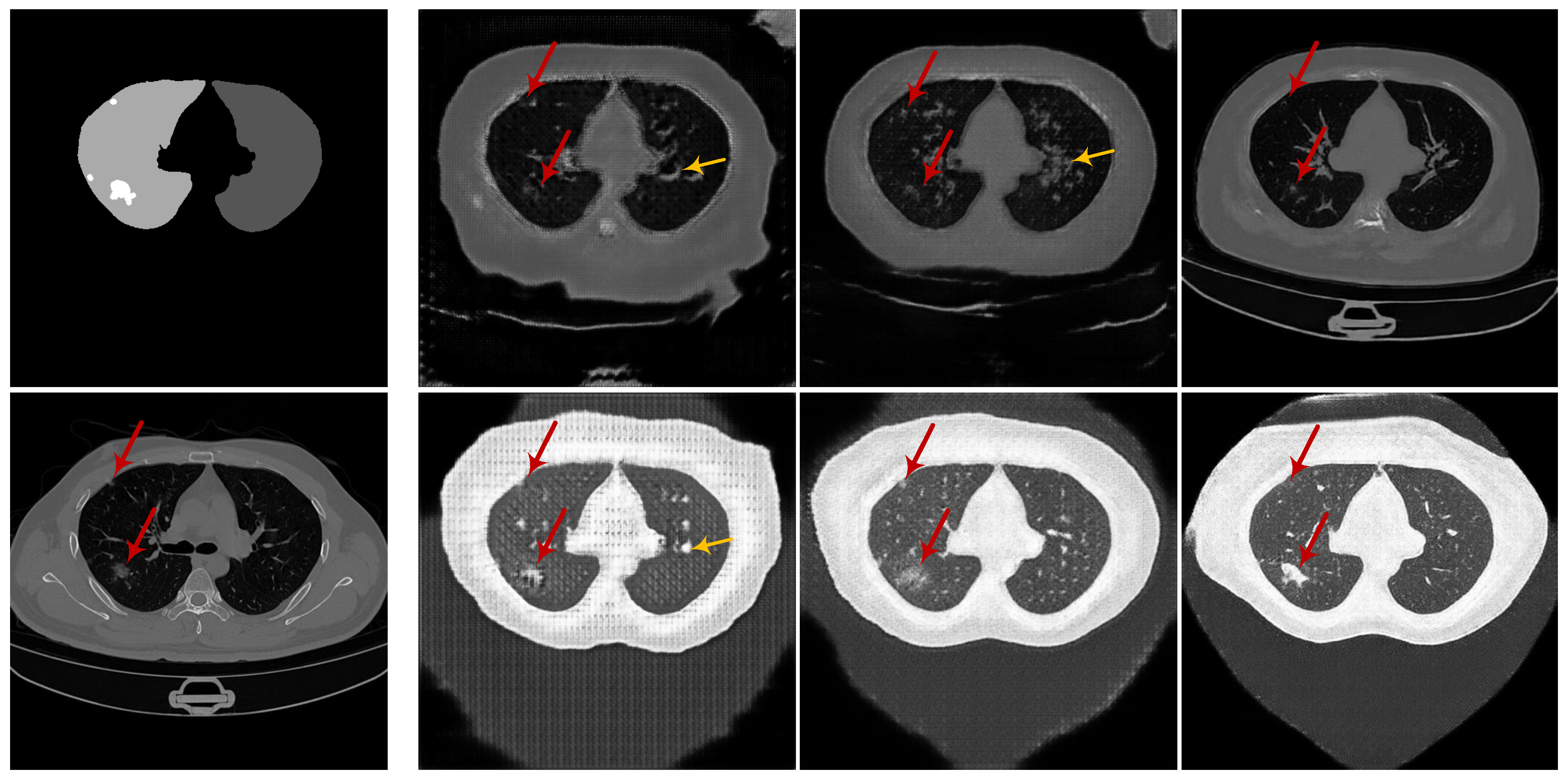 Diagnostics 10 00901 g010 Diagnostics 10 00901 g010