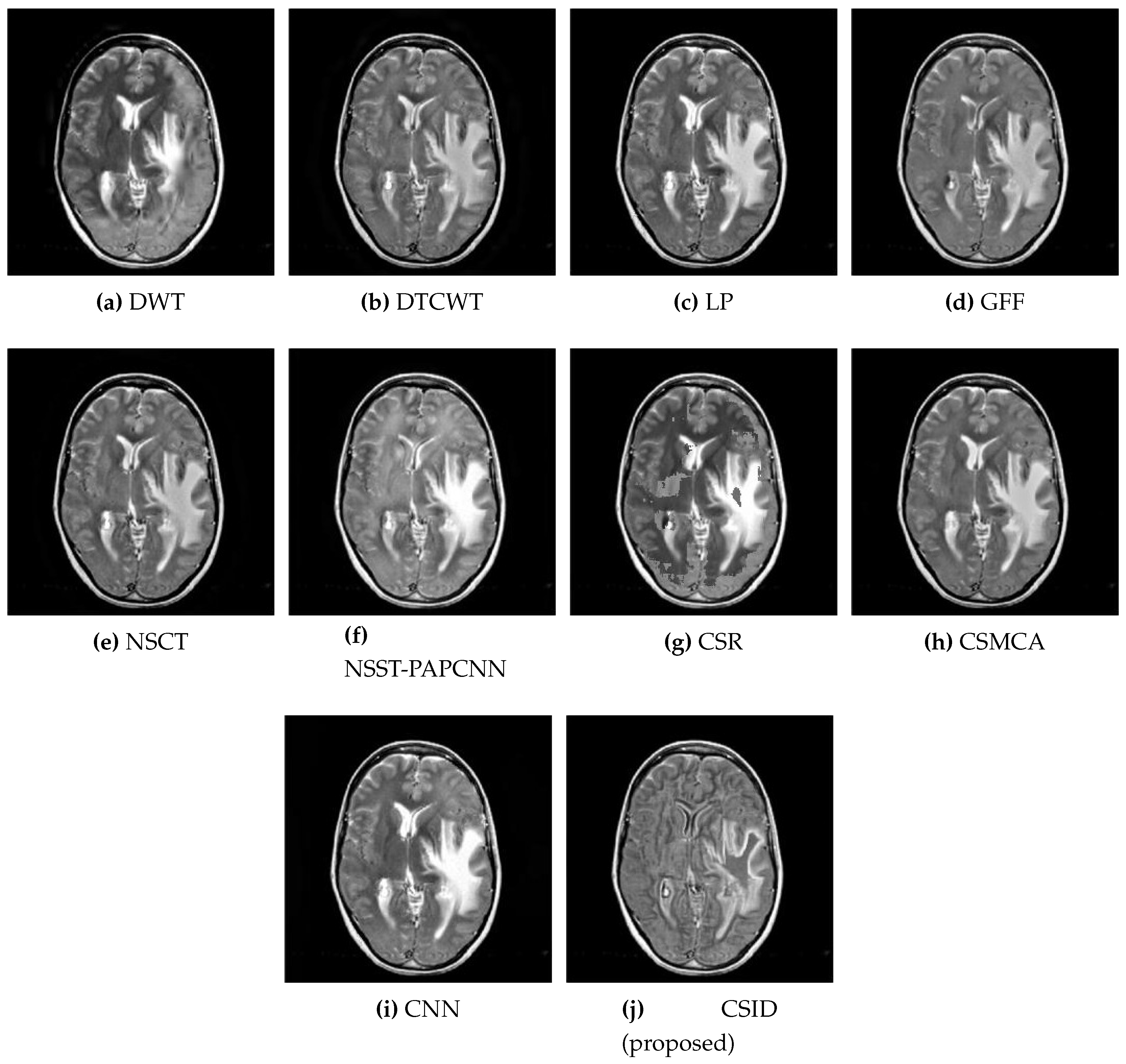 Diagnostics 10 00904 g006