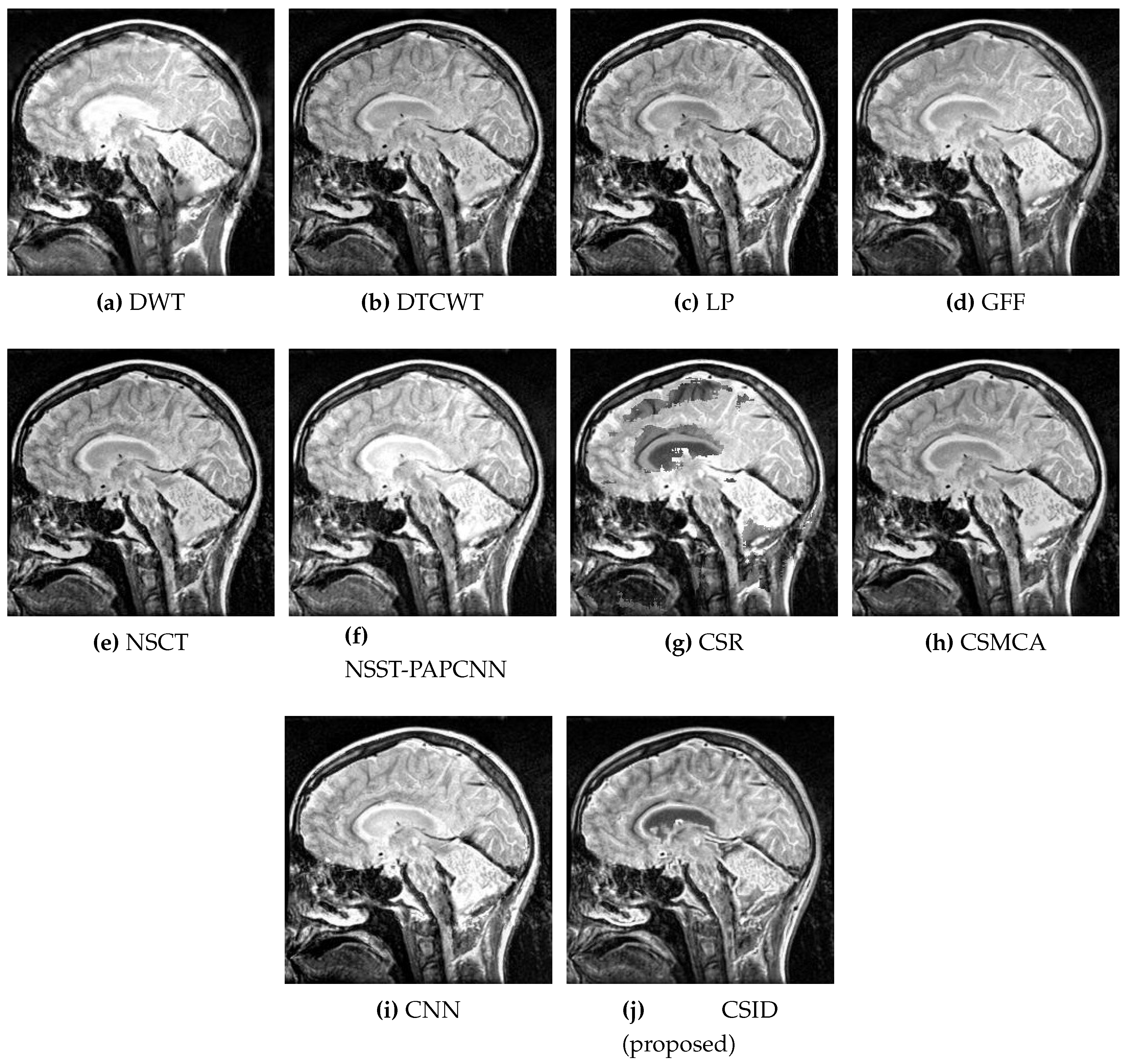 Diagnostics 10 00904 g008