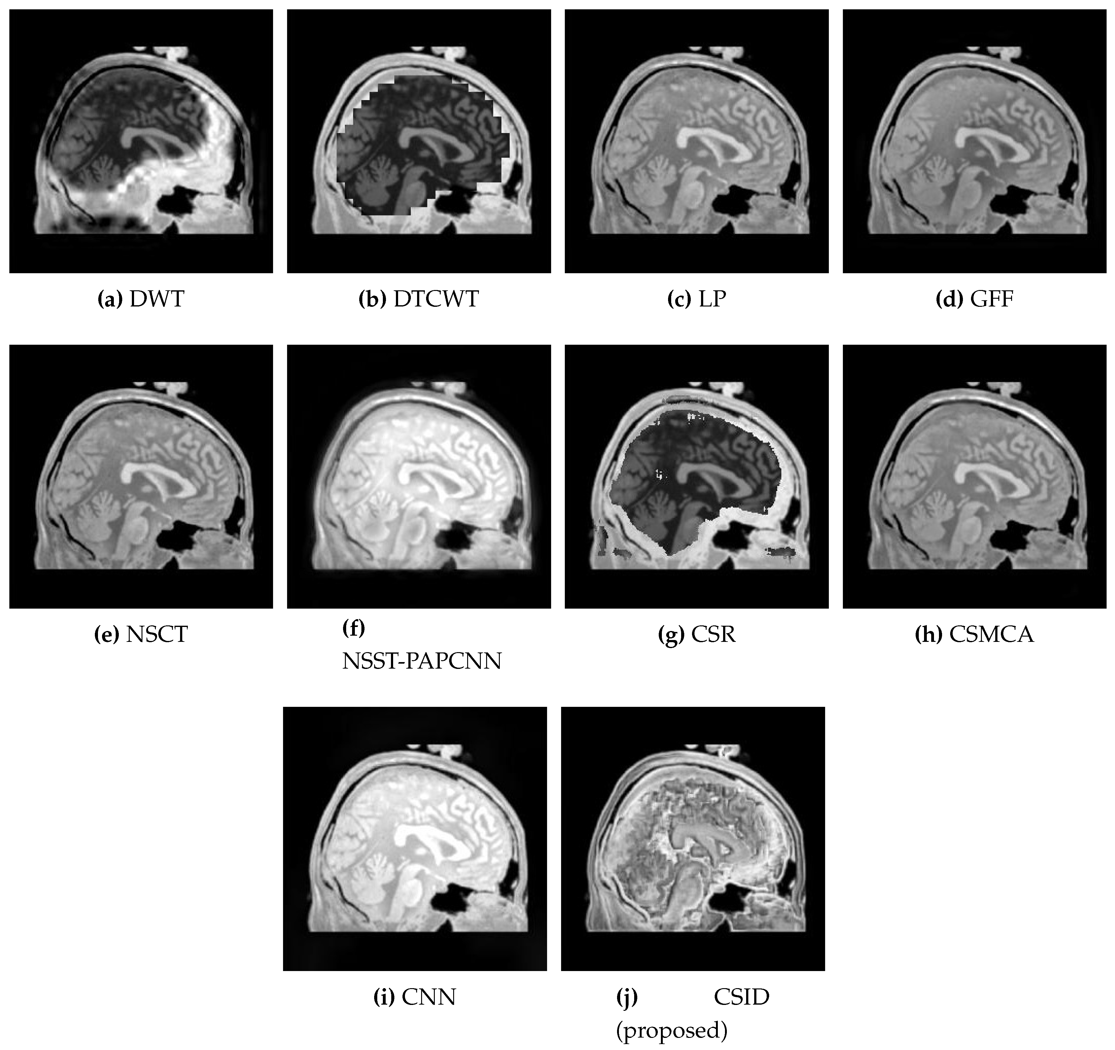 Diagnostics 10 00904 g009