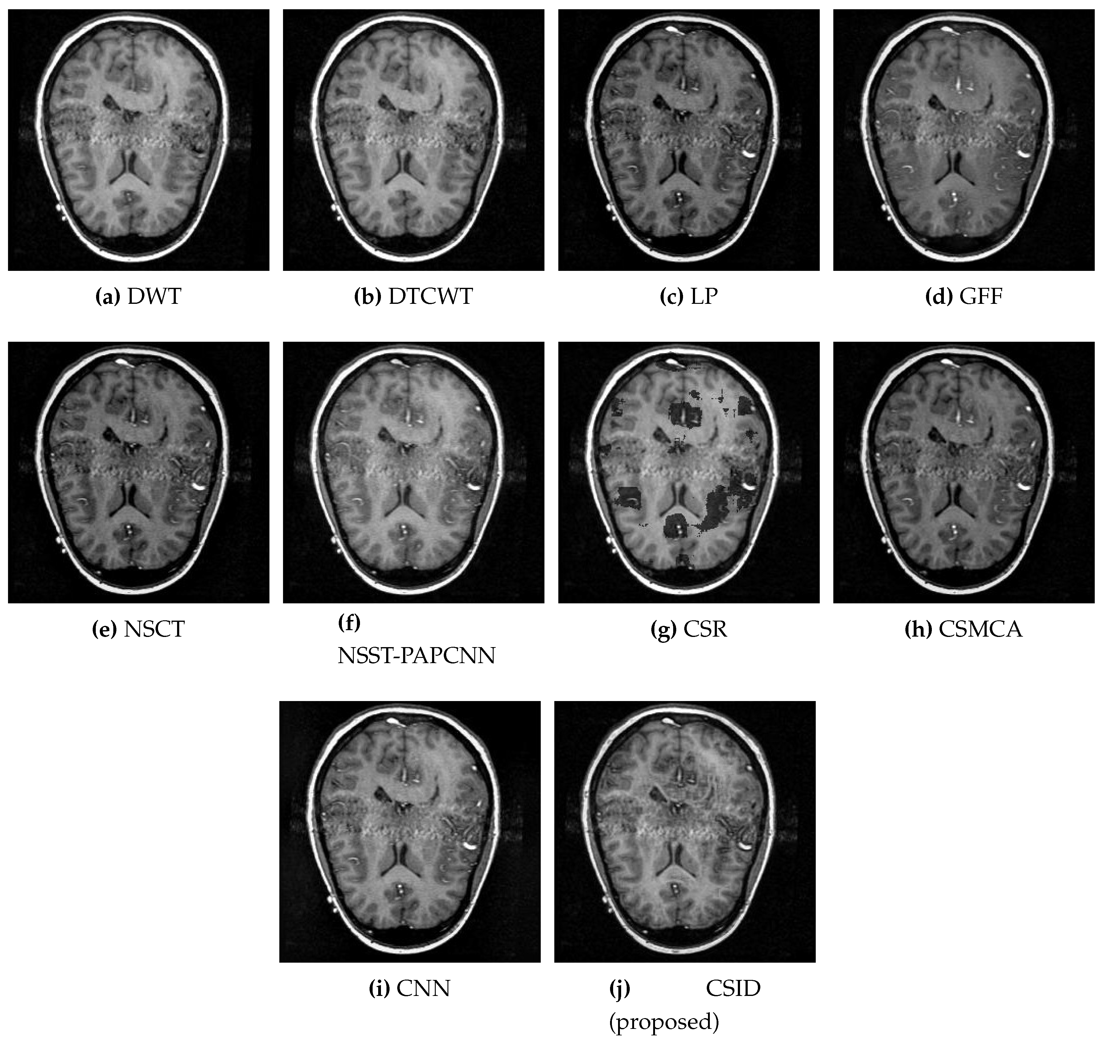 Diagnostics 10 00904 g010