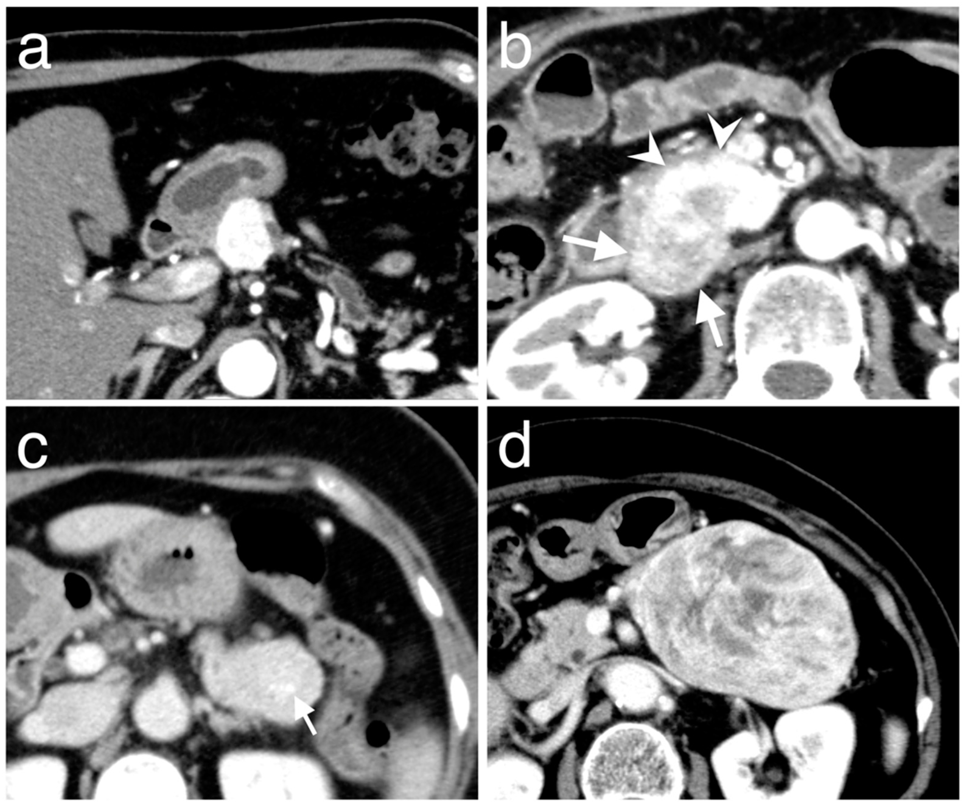 Diagnostics 10 00919 g002 Diagnostics 10 00919 g002