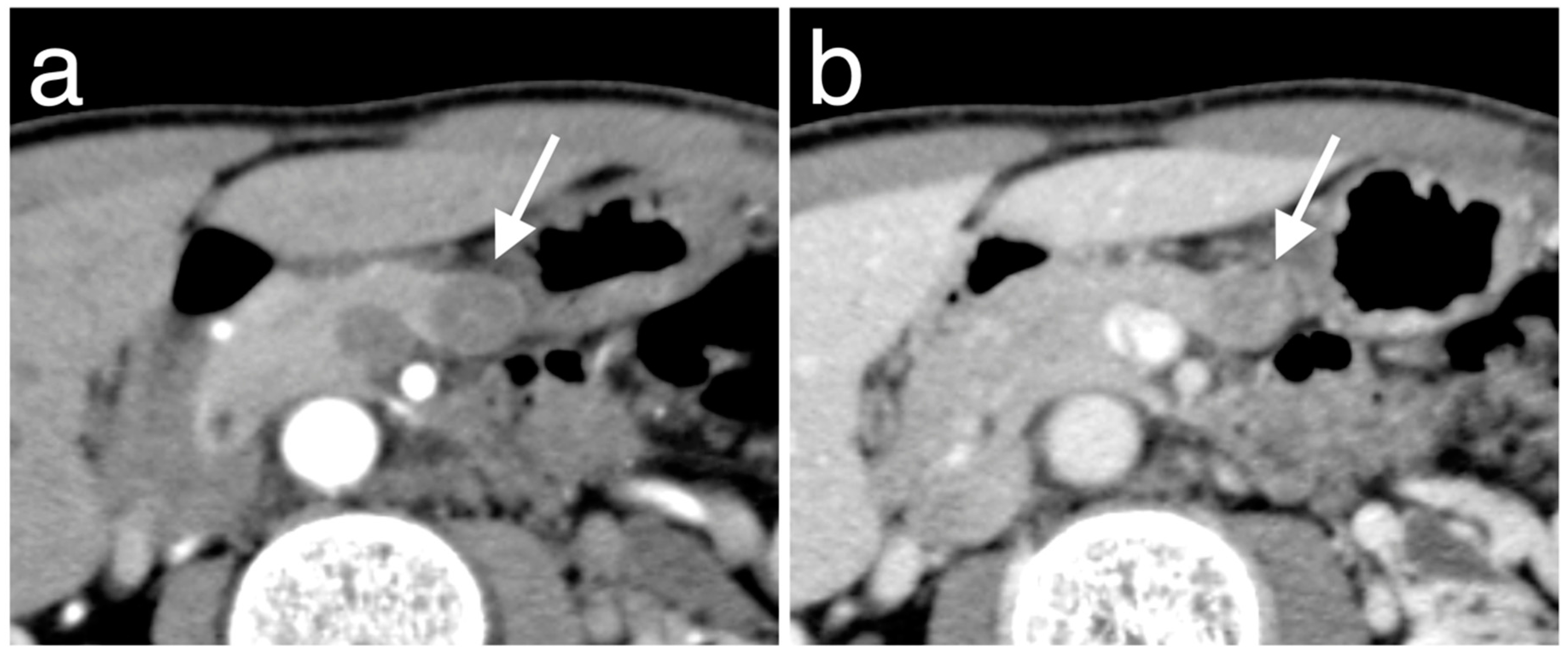 Diagnostics 10 00919 g004 Diagnostics 10 00919 g004
