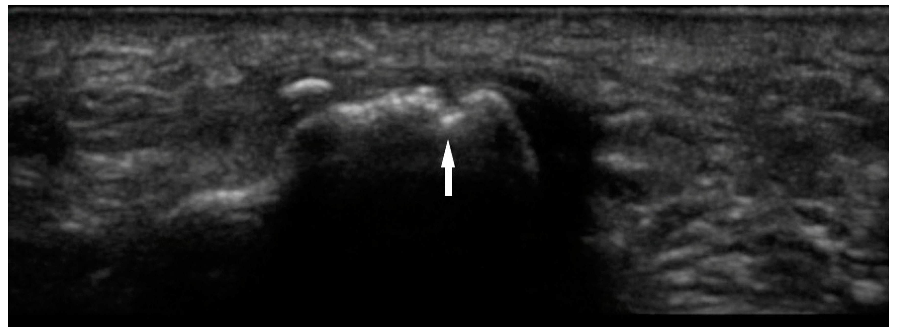 Diagnostics 10 00933 g004