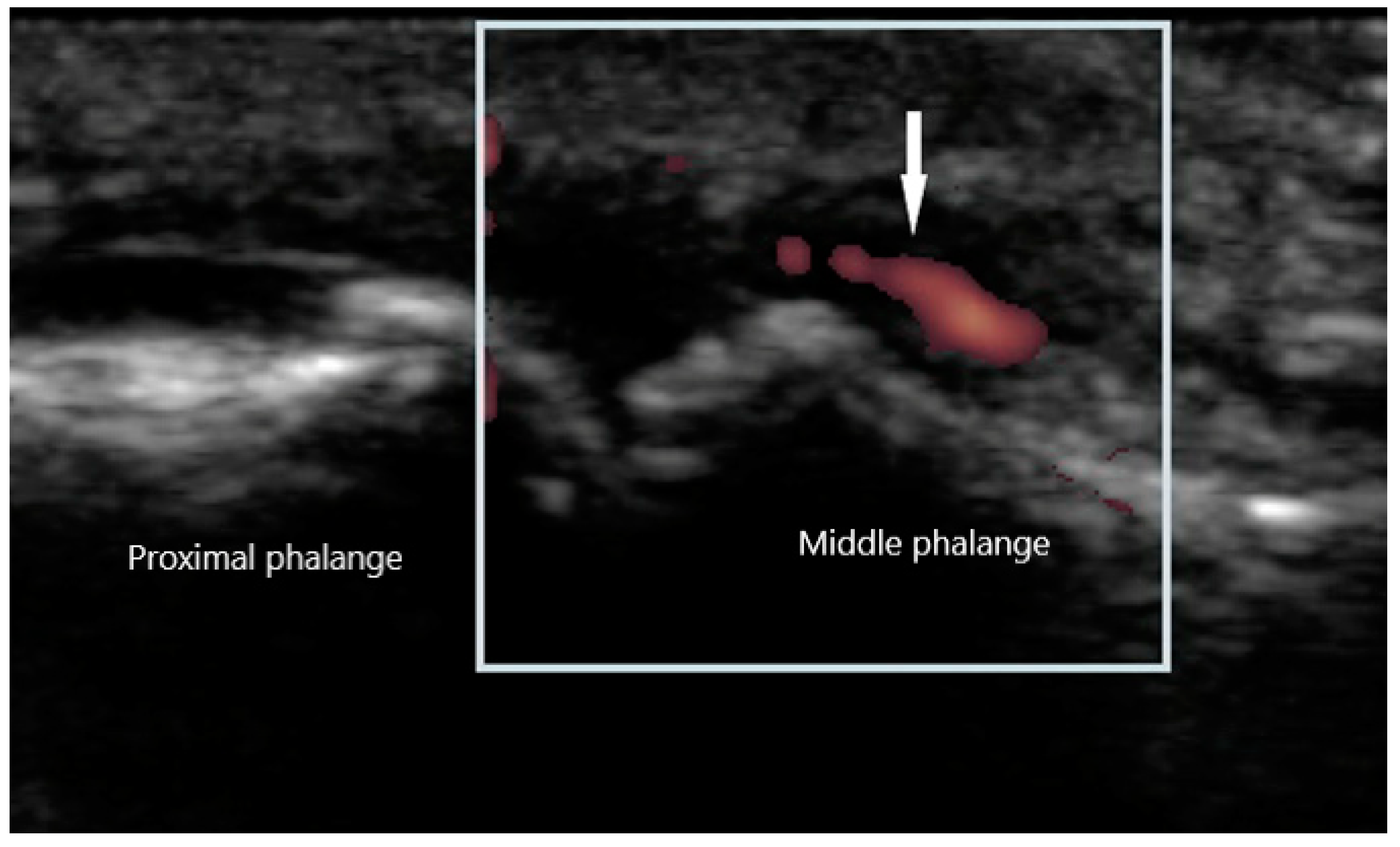 Diagnostics 10 00933 g005