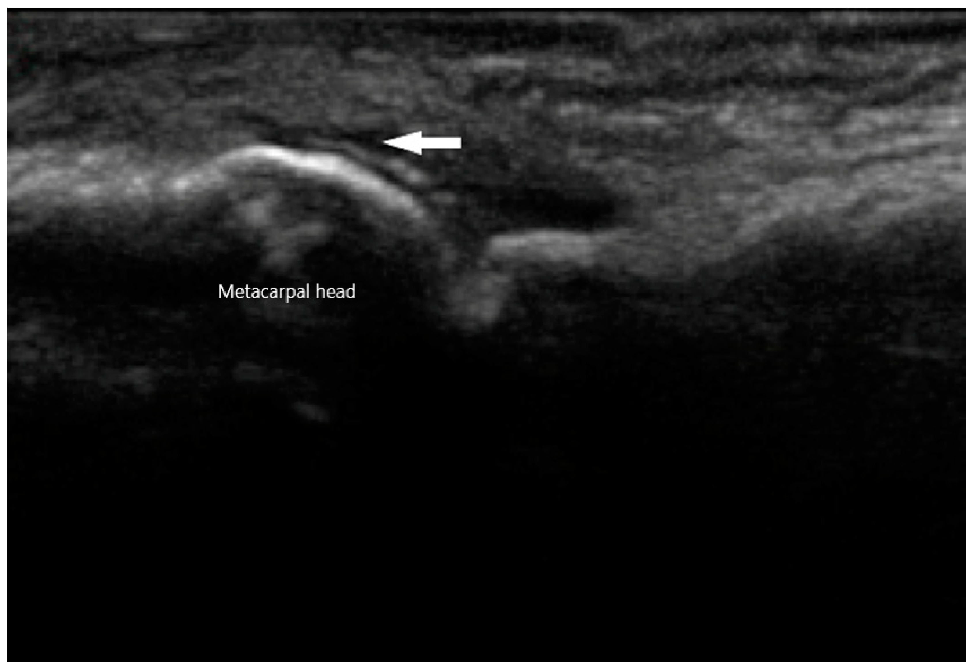 Diagnostics 10 00933 g009