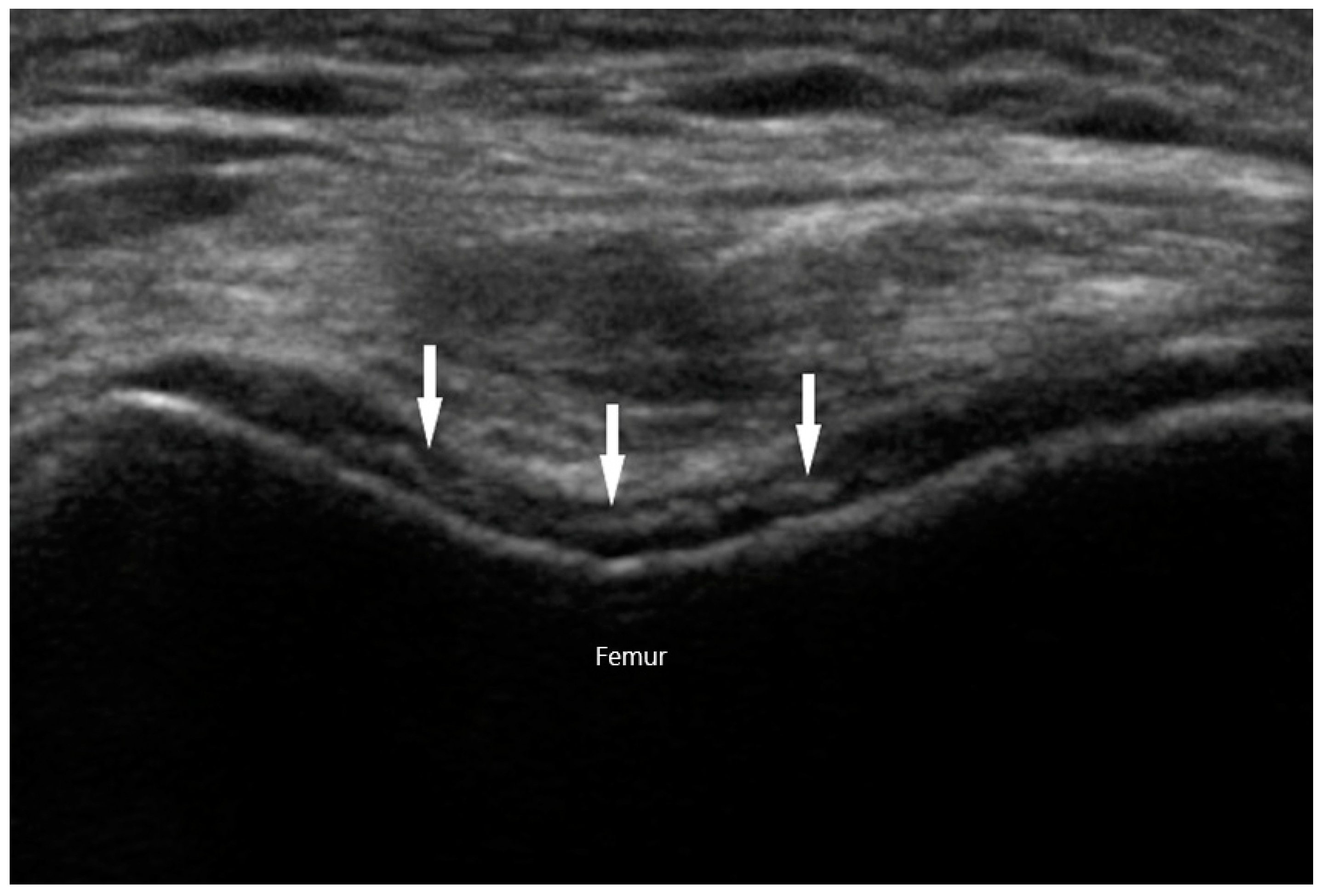 Diagnostics 10 00933 g010